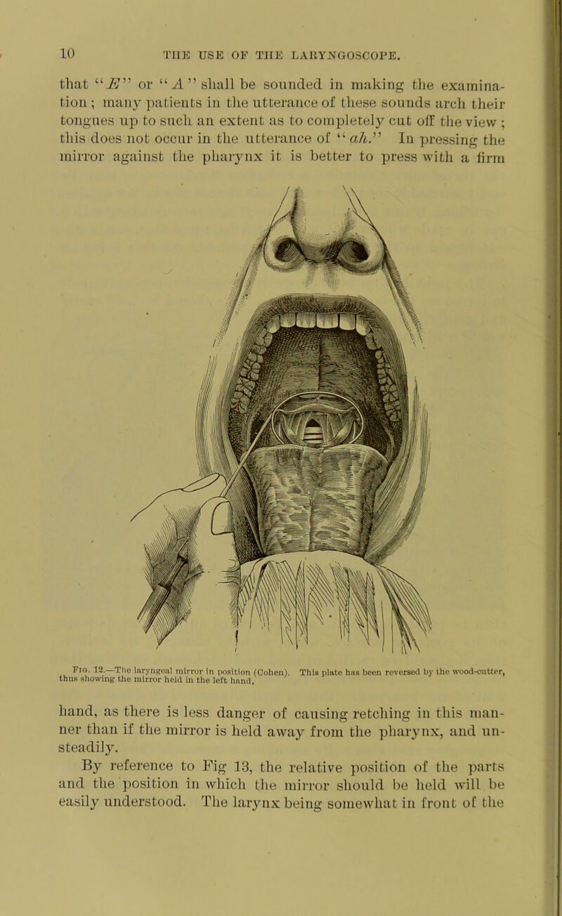 that “i?” or “A” shall be sounded in making the examina- tion ; many patients in the utterance of these sounds arch their tongues up to such an extent as to completely cut off the view ; this does not occur in the utterance of “ ah.” In pressing the mirror against the pharynx it is better to press with a firm Fig. 12.—The laryngeal mirror in position (Cohen), thus showing the mirror held in the left hand. This plate has been reversed by the wood-cutter, hand, as there is less danger of causing retching in this man- ner than if the mirror is held away from the pharynx, and un- steadily. By reference to Fig 13, the relative position of the parts and the position in which the mirror should be held will be easily understood. The larynx being somewhat in front of the