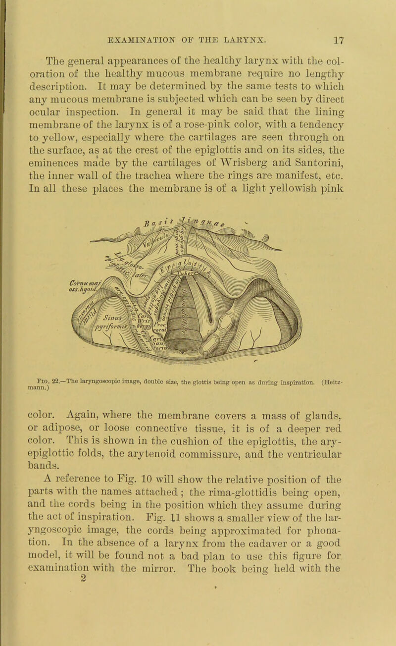 The general appearances of the healthy larynx with the col- oration of the healthy mucous membrane require no lengthy description. It may be determined by the same tests to which any mucous membrane is subjected which can be seen by direct ocular inspection. In general it may be said that the lining membrane of the larynx is of a rose-pink color, with a tendency to yellow, especially where the cartilages are seen through on the surface, as at the crest of the epiglottis and on its sides, the eminences made by the cartilages of Wrisberg and Santorini, the inner wall of the trachea where the rings are manifest, etc. In all these places the membrane is of a light yellowish pink Fig. 22.—The laryngoscopic image, double size, the glottis being open as during inspiration. (Heitz- mann.) color. Again, where the membrane covers a mass of glands, or adipose, or loose connective tissue, it is of a deeper red color. This is shown in the cushion of the epiglottis, the ary- epiglottic folds, the arytenoid commissure, and the ventricular bands. A reference to Fig. 10 will show the relative position of the parts with the names attached ; the rima-glottidis being open, and the cords being in the position which they assume during the act of inspiration. Fig. 11 shows a smaller view of the lar- yngoscopic image, the cords being approximated for pliona- tion. In the absence of a larynx from the cadaver or a good model, it will be found not a bad plan to use this figure for examination with the mirror. The book being held with the