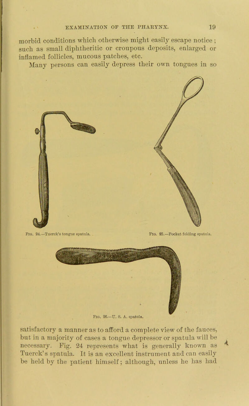 morbid conditions which otherwise might easily escape notice ; such as small diphtheritic or croupous deposits, enlarged or inflamed follicles, mucous patches, etc. Many persons can easily depress their own tongues in so Fig. 24.—Tuerck’s tongue spatula. Fig. 25.—Pocket folding spatula. Fig. 26.—IT. S. A, spatula. satisfactory a manner as to afford a complete view of the fauces, but in a majority of cases a tongue depressor or spatula will be necessary. Fig. 24 represents what is generally known as Tuerck’s spatula. It is an excellent instrument and can easily be held by the patient himself; although, unless he has had