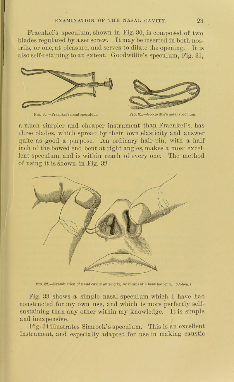 Flo. 30.—Fraenkel’s nasal speculum. Fig. 31.—Goodwillie’s nasal speculum. a much simpler and cheaper instrument than Fraenkel’s, has three blades, which spread by their own elasticity and answer quite as good a purpose. An ordinary hair-pin, with a half inch of the bowed end bent at right angles, makes a most excel- lent speculum, and is within reach of every one. The method of using it is shown in Fig. 32. Fig. 33 shows a simple nasal speculum which I have had constructed for my own use, and which is more perfectly self- sustaining than any other within my knowledge. It is simple and inexpensive. Fig. 34 illustrates Simrock’s speculum. This is an excellent instrument, and especially adapted for use in making caustic Fraenkel’s speculum, shown in Fig. 30, is composed of two blades regulated by a set screw. It may be inserted in both nos- trils, or one, at pleasure, and serves to dilate the opening. It is also self-retaining to an extent. Goodwillie’s speculum, Fig. 31, Fig. 32.—Examination of nasal cavity anteriorly, by means of a bent hair-pin. (Cohen.)