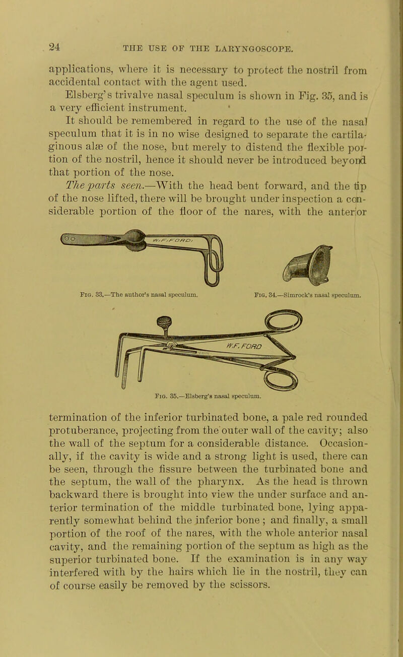 applications, where it is necessary to protect the nostril from accidental contact with the agent used. Elsberg’s trivalve nasal speculum is shown in Fig. 35, and is a very efficient instrument. It should be remembered in regard to the use of the nasal speculum that it is in no wise designed to separate the cartila- ginous aim of the nose, but merely to distend the flexible por- tion of the nostril, hence it should never be introduced beyond that portion of the nose. The parts seen.—With the head bent forward, and the tip of the nose lifted, there will be brought under inspection a con- siderable portion of the floor of the nares, with the anterior Fig. 35.—Elsberg'B nasal speculum. termination of the inferior turbinated bone, a pale red rounded protuberance, projecting from the'outer wall of the cavity; also the wall of the septum for a considerable distance. Occasion- ally, if the cavity is wide and a strong light is used, there can be seen, through the fissure between the turbinated bone and the septum, the wall of the pharynx. As the head is thrown backward there is brought into view the under surface and an- terior termination of the middle turbinated bone, lying appa- rently somewhat behind the inferior bone ; and finally, a small portion of the roof of the nares, with the whole anterior nasal cavity, and the remaining portion of the septum as high as the superior turbinated bone. If the examination is in any way interfered with by the hairs which lie in the nostril, they can of course easily be removed by the scissors.
