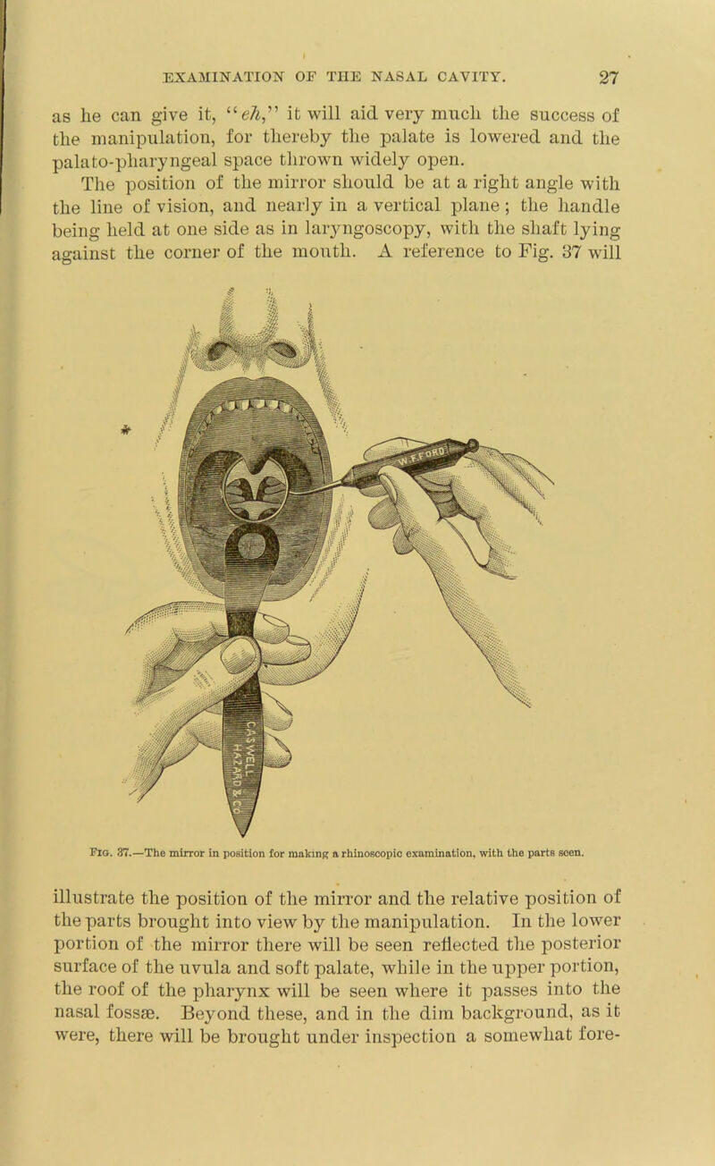 as he can give it, “eh,” it will aid very much the success of the manipulation, for thereby the palate is lowered and the palato-pharyngeal space thrown widely open. The position of the mirror should be at a right angle with the line of vision, and nearly in a vertical plane; the handle being held at one side as in laiyngoscopy, with the shaft lying against the corner of the mouth. A reference to Fig. 37 will Fig. 37.—The mirror in position for making a rhinoscopic examination, with the parts seen. illustrate the position of the mirror and the relative position of the parts brought into view by the manipulation. In the lower portion of the mirror there will be seen reflected the posterior surface of the uvula and soft palate, while in the upper portion, the roof of the pharynx will be seen where it passes into the nasal fossae. Beyond these, and in the dim background, as it were, there will be brought under inspection a somewhat fore-
