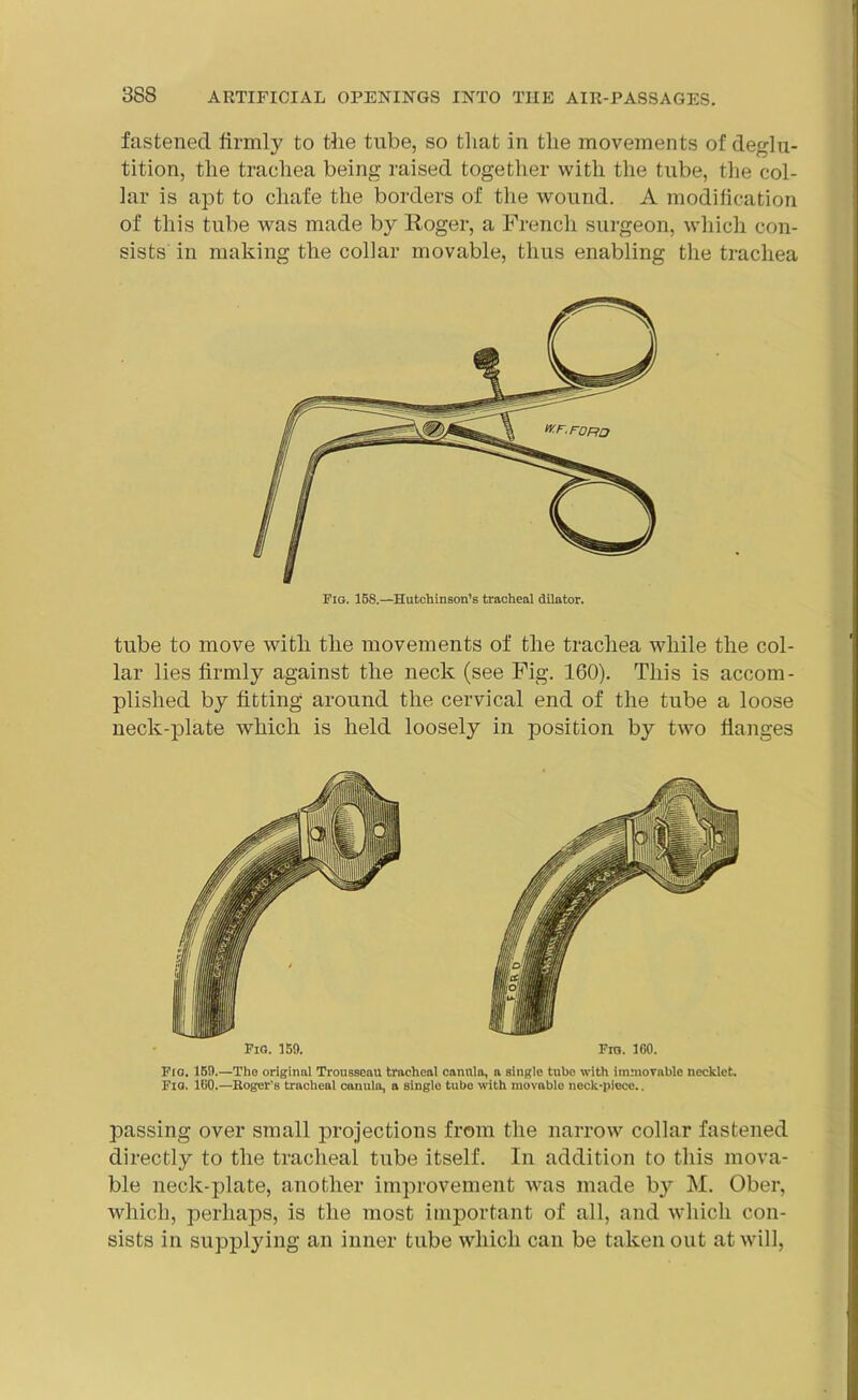 fastened firmly to the tube, so that in the movements of deglu- tition, the trachea being raised together with the tube, the col- lar is apt to chafe the borders of the wound. A modification of this tube was made by Roger, a French surgeon, which con- sists in making the collar movable, thus enabling the trachea Fig. 15S.—Hutchinson’s tracheal dilator. tube to move with the movements of the trachea Avliile the col- lar lies firmly against the neck (see Fig. 160). This is accom- plished by fitting around the cervical end of the tube a loose neck-plate which is held loosely in position by two flanges Fig. 159. Fro. ICO. Fio. 159.—The original Trousseau tracheal cannla, a single tubo with immovable necklet. Fig. ICO.—Hoger’s tracheal canula, a single tube with movable neck-piece.. passing over small projections from the narrow collar fastened directly to the tracheal tube itself. In addition to this mova- ble neck-plate, another improvement was made by M. Ober, which, perhaps, is the most important of all, and which con- sists in supplying an inner tube which can be taken out at will,