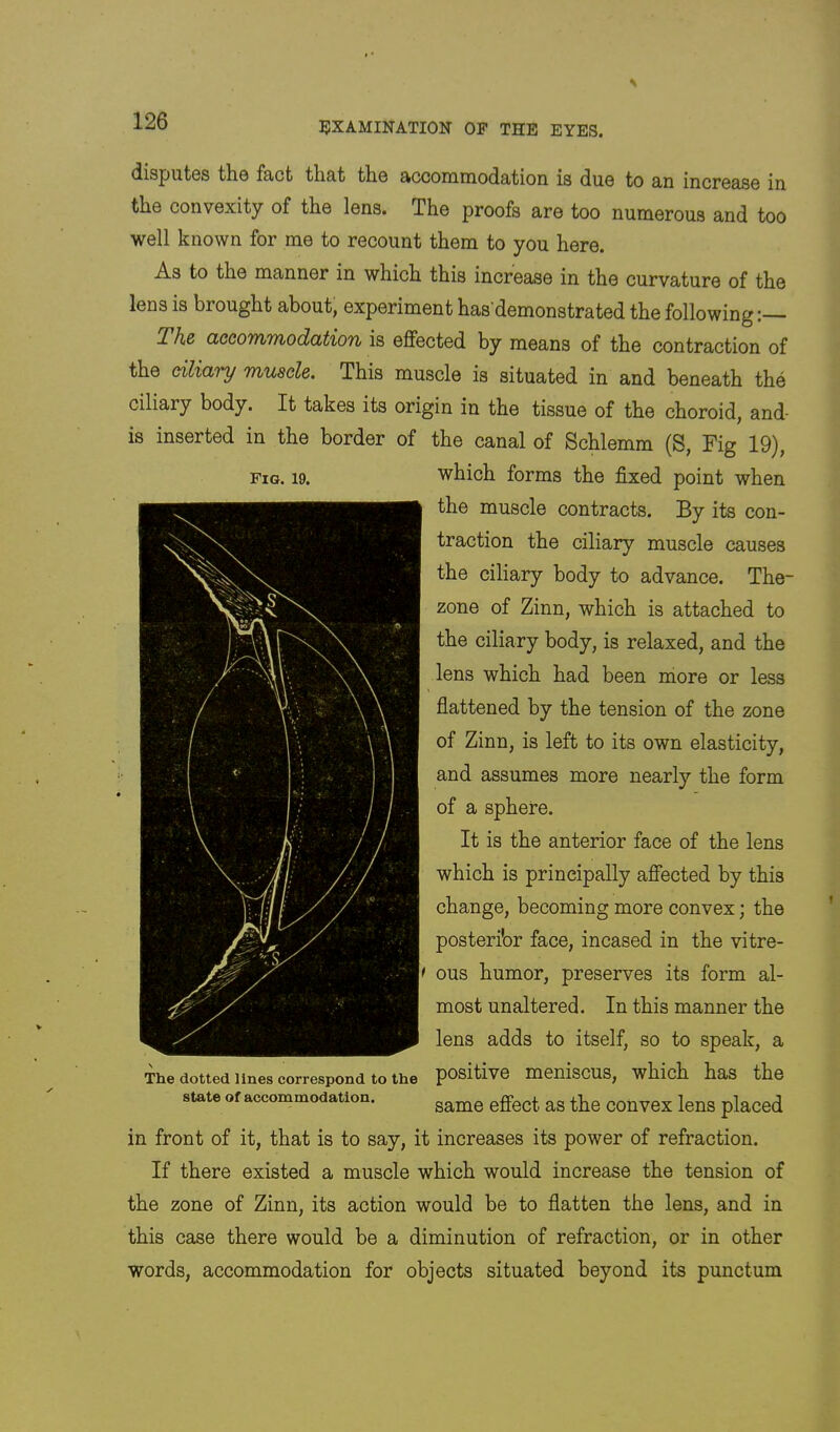 disputes the fact that the acconiiiiodation is due to an increase in the convexity of the lens. The proofs are too numerous and too well known for me to recount them to you here. As to the manner in which this increase in the curvature of the lens is brought about, experiment has demonstrated the following:— Th& CLCcoTYiTnodcition is effected by means of the contraction of the ciliary muscle. This muscle is situated in and beneath the ciliary body. It takes its origin in the tissue of the choroid, and- is inserted in the border of the canal of Schlemm (S, Fig 19), Fig. 19. which forms the fixed point when the muscle contracts. By its con- traction the ciliary muscle causes the ciliary body to advance. The- zone of Zinn, which is attached to the ciliary body, is relaxed, and the lens which had been more or less flattened by the tension of the zone of Zinn, is left to its own elasticity, and assumes more nearly the form of a sphere. It is the anterior face of the lens which is principally affected by this change, becoming more convex; the posterior face, incased in the vitre- ous humor, preserves its form al- most unaltered. In this manner the lens adds to itself, so to speak, a The dotted lines correspond to the pOsitive menisCUS, which haS the state of accommodation. in front of it, that is to say, it increases its power of refraction. If there existed a muscle which would increase the tension of the zone of Zinn, its action would be to flatten the lens, and in this case there would be a diminution of refraction, or in other words, accommodation for objects situated beyond its punctum