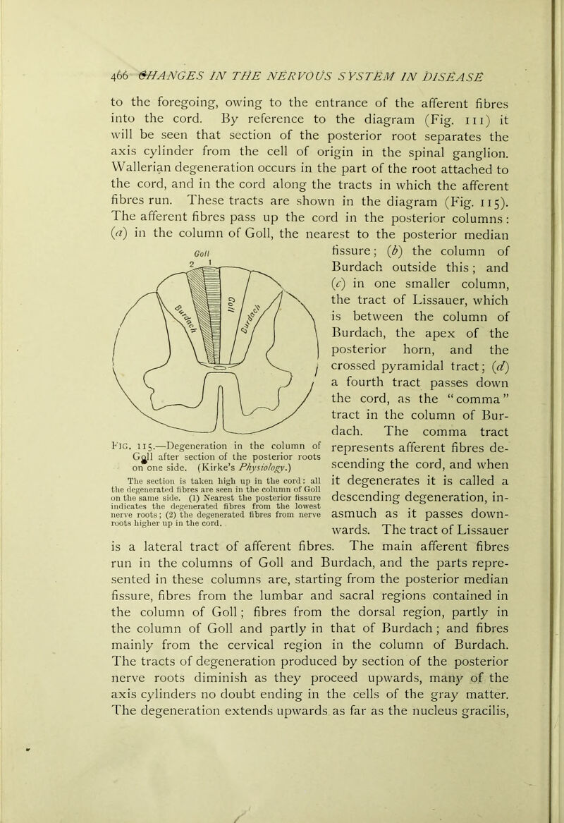 to the foregoing, owing to the entrance of the afferent fibres into the cord. By reference to the diagram (Fig. in) it will be seen that section of the posterior root separates the axis cylinder from the cell of origin in the spinal ganglion. Wallerian degeneration occurs in the part of the root attached to the cord, and in the cord along the tracts in which the afferent fibres run. These tracts are shown in the diagram (Fig. 115). The afferent fibres pass up the cord in the posterior columns : (a) in the column of Goll, the nearest to the posterior median fissure; (d) the column of Burdach outside this; and (c) in one smaller column, the tract of Lissauer, which is between the column of Burdach, the apex of the posterior horn, and the crossed pyramidal tract; (d) a fourth tract passes down the cord, as the “comma” tract in the column of Bur- dach. The comma tract represents afferent fibres de- scending the cord, and when it degenerates it is called a descending degeneration, in- asmuch as it passes down- wards. The tract of Lissauer is a lateral tract of afferent fibres. The main afferent fibres run in the columns of Goll and Burdach, and the parts repre- sented in these columns are, starting from the posterior median fissure, fibres from the lumbar and sacral regions contained in the column of Goll; fibres from the dorsal region, partly in the column of Goll and partly in that of Burdach; and fibres mainly from the cervical region in the column of Burdach. The tracts of degeneration produced by section of the posterior nerve roots diminish as they proceed upwards, man}^ of the axis cylinders no doubt ending in the cells of the gray matter. The degeneration extends upwards as far as the nucleus gracilis, Goll Kig. 115.—Degeneration in the column of Ggll after section of the posterior roots on one side. (Kirke’s Physiology.) Tlie section is taken Iiigli iip in the cord: all tlie degenerated fibres are seen in the column of Goll on the same side. (1) Nearest the posterior fissure indicates the degenerated fibres from the lowest nerve roots; (2) the degenerated fibres from nerx'e roots higher up in the cord.