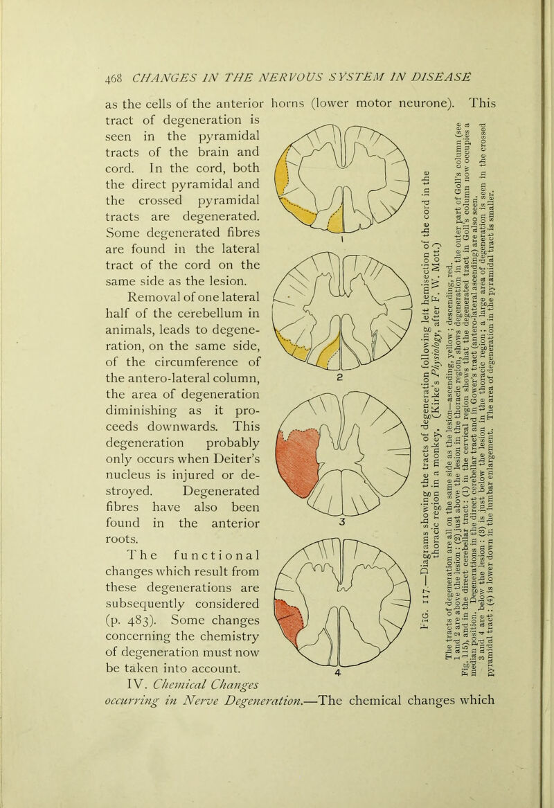 as the cells of the anterior tract of degeneration is seen in the pyramidal tracts of the brain and cord. In the cord, both the direct pyramidal and the crossed pyramidal tracts are degenerated. Some degenerated fibres are found in the lateral tract of the cord on the same side as the lesion. Removal of one lateral half of the cerebellum in animals, leads to degene- ration, on the same side, of the circumference of the antero-lateral column, the area of degeneration diminishing as it pro- ceeds downwards. This degeneration probably only occurs when Deiter’s nucleus is injured or de- stroyed. Degenerated fibres have also been found in the anterior roots. The functional changes which result from these degenerations are subsequently considered (p. 483). Some changes concerning the chemistry of degeneration must now be taken into account. IV. Chemical Changes occurring in Nerve Degenet horns (lower motor neurone). This ■ation.—The chemical changes which