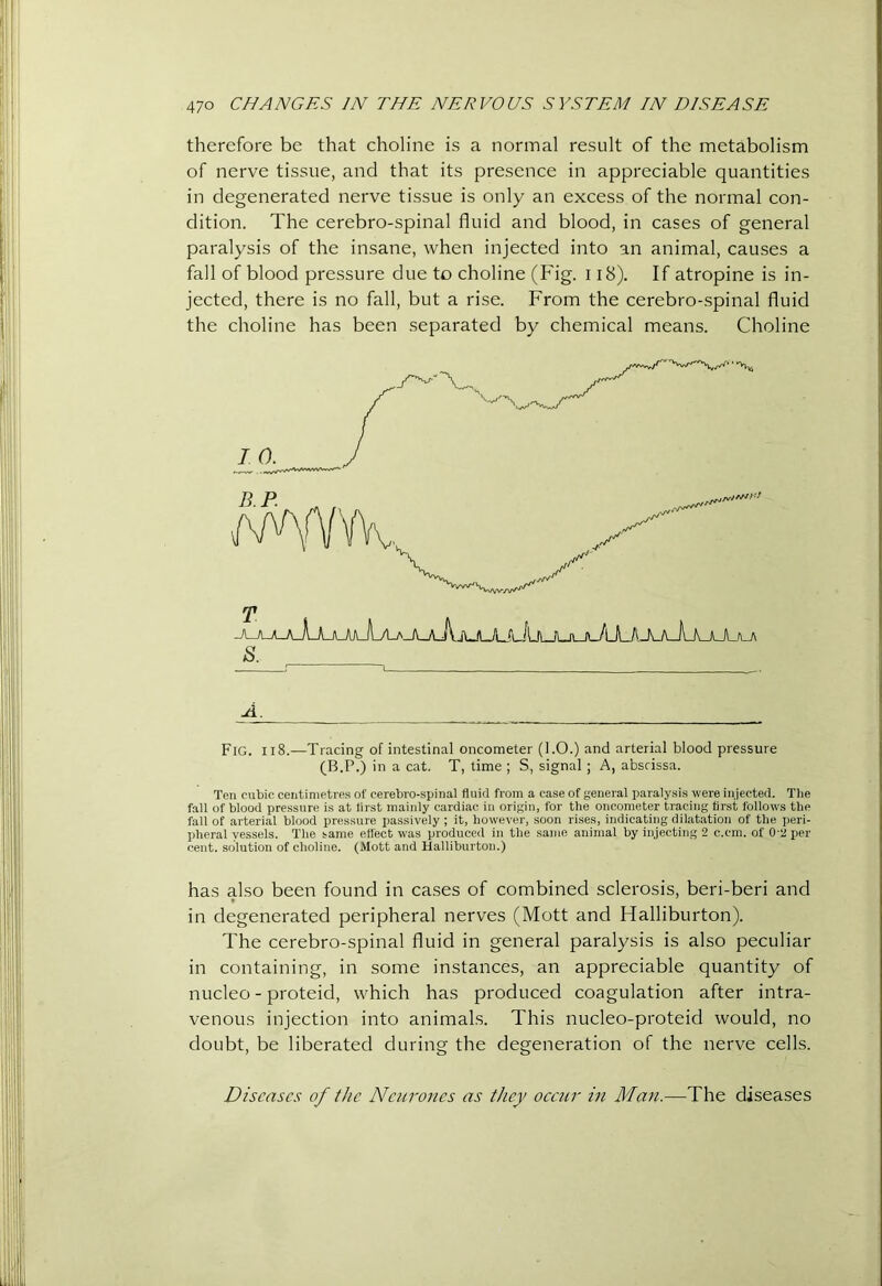 therefore be that choline is a normal result of the metabolism of nerve tissue, and that its presence in appreciable quantities in degenerated nerve tissue is only an excess of the normal con- dition. The cerebro-spinal fluid and blood, in cases of general paralysis of the insane, when injected into an animal, causes a fall of blood pressure due to choline (Fig. 118). If atropine is in- jected, there is no fall, but a rise. From the cerebro-spinal fluid the choline has been separated by chemical means. Choline T -J'^-^L-LJ^-LEjLJuJ\AL^jLAj\jUiAjJ\jUUUlJL^ s. A. Fig. ii8.—Tracing of intestinal oncometer (1.0.) and arterial blood pressure (B.P.) in a cat. T, time ; S, signal ; A, abscissa. Ten cubic centimetres of cerebro-spinal fluid from a case of general paralysis were injected. Tlie fall of blood pressure is at first mainly cardiac in origin, for the oncometer tracing first follows the fall of arterial blood pressure passively ; it, however, soon rises, indicating dilatation of the peri- pheral vessels. The same efl'ect was produced in the saiTie animal by injecting 2 c.cm. of 0-2 per cent, solution of choline. (Mott and Halliburton.) has also been found in cases of combined sclerosis, beri-beri and in degenerated peripheral nerves (Mott and Halliburton). The cerebro-spinal fluid in general paralysis is also peculiar in containing, in some instances, an appreciable quantity of nucleo - proteid, which has produced coagulation after intra- venous injection into animals. This nucleo-proteid would, no doubt, be liberated during the degeneration of the nerve cells. Diseases of the Neurones as they occur m Man.—The diseases