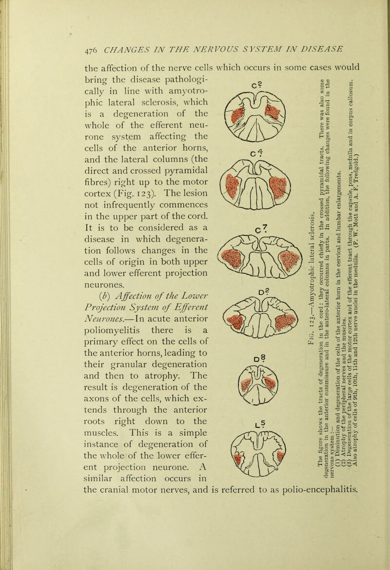 some cases would 5s 2 the affection of the nerve cells which occurs in bring the disease pathologi- cally in line with am)'otro- phic lateral sclerosis, which is a degeneration of the whole of the efferent neu- rone system affecting the cells of the anterior horns, and the lateral columns (the direct and crossed pyramidal fibres) right up to the motor cortex (Fig. 123). The lesion not infrequently commences in the upper part of the cord. It is to be considered as a disease in which degenera- tion follows changes in the cells of origin in both upper and lower efferent projection neurones. ij)) Ajfection of the Lower Projection System of Efferent Neurones.—In acute anterior poliomyelitis there is a primary effect on the cells of the anterior horns, leading to their granular degeneration and then to atrophy. The result is degeneration of the axons of the cells, which ex- tends through the anterior roots right down to the muscles. This is a simple instance of degeneration of the whole of the lower effer- ent projection neurone. A similar affection occurs in the cranial motor nerves, and is referred to as polio-encephalitis. o £ B§> a a bO . O ^ « 2 03^ 05 4^ C3 o § a -43 S ^ r- O ^ o « 03-grH S'g ^ O c3 ° § ;2 « go 03 a ® ^ 08 03 S3 o 03 'a O' S ® ° ^03 'O (>3 ^ ^ <13 O 03 >• a a o S I c ^ .2 o “ ^ 'r-' ^ ^ 03 .a G n; rC 03 a 03 a c o G G 'p o a ?H <G 4-3 03 c3 u o o 03 03 ^ 03 03