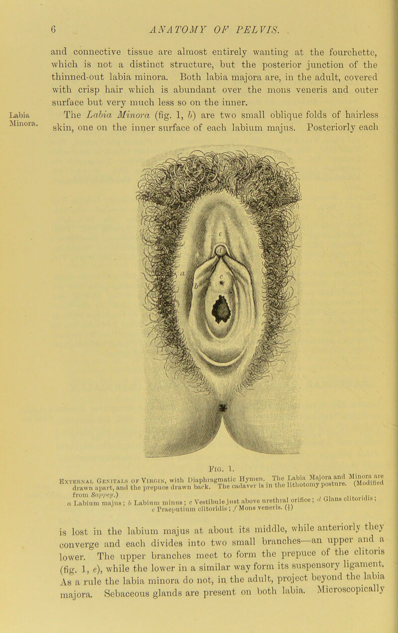 Labia iMinora. and connective tissue are almost entirely wanting at the fourchette, which is not a distinct structure, but the posterior junction of the thinned-out labia minora. Both labia majora ai’e, in the adult, covered with crisp hair which is abundant over the mons veneris and outer sui’face but very much less so on the inner. The Lahia Minora (fig. 1, h) are two small oblique folds of hairless skin, one on the inner surface of each labium majus. Posteriorly each l<’Ki. 1. Extbunai, GE.MTAI.S OK ViKOiN, witli Diiiphiugmatio Hymen. Tlie ^modiHed drawn apiirt, and the prepuce drawn back. The cadaver le in tlie litliotoray posture, (flloaine (I Labium majus ; b Labium minus ; c Vestibule just above urethral orifice , d Gians olitor idis , c Pnieuutium clitoridia ; ./‘Mons veneris. (^) is lost in the labium majus at about its middle, while anteriorly the} converge and each divides into two small branches—an upper and a lower. The upper branches meet to form the prepuce of the clitoiis (fig. 1, e), while the lower in a similar way form its suspensory ligament. As a rule the labia minora do not, in the adult, project beyond the labia majora. Sebaceous glands are present on both labia. Microscopically