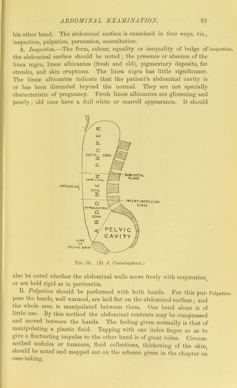 his other hand. The abdominal surface is examined in four ways, viz., inspection, palpation, percussion, auscultation. A. Inspection.—The form, colour, equality or inequality of bulge of Inspection, the abdominal surface should be noted; the presence or absence of the linea nigra, lineee albicantes (fresh and old), pigmentary deposits, fat streaks, and skin eruptions. The linea nigra has little significance. The linese albicantes indicate that the patient’s abdominal cavity is or has been distended beyond the normal. They are not specially characteristic of pregnancy. Fresh linem albicantes are glistening and pearly; old ones have a dull white or scarre'd appearance. It should Fig. 55. (D. J. Cunningham.) also be noted whether the abdominal walls move freely with respiration or are held rigid as in peritonitis. B. Palpation should be performed with both hands. For this pur-Palpation, pose the hands, well warmed, are laid flat on the abdominal surface; and the whole area is manipulated between them. One hand alone is of little use. By this method the abdominal contents may be compressed and moved between the hands. The feeling given normally is that of manipulating a plastic fluid. Tapping with one index finger so as to give a fluctuating impulse to the other hand is of great value. Circum- scribed nodules or tumours, fluid collections, thickening of the skin should be noted and mapped out on the scheme given in the chapter on case-taking.