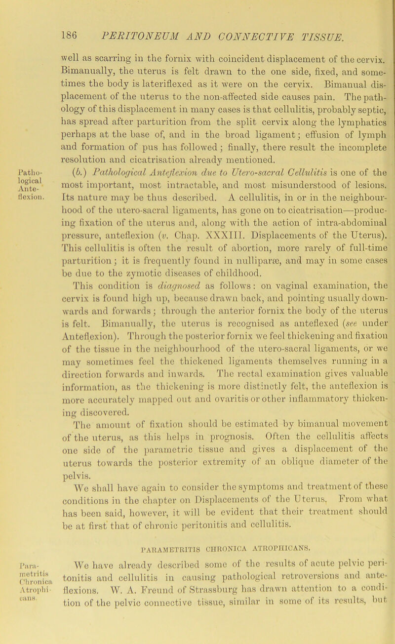 Patho- logical Ante- Hexioii. Piira- inetiitis Chronica Atrophi- cans. well as scarring in the fornix with coincident displacement of the cervix. Bimanually, the uterus is felt drawn to the one side, fixed, and some- times the body is lateriflexed as it were on the cervix. Bimanual dis- placement of the uterus to the non-affected side causes pain. The path- ology of this displacement in many cases is that cellulitis, probably septic, lias spread after parturition from the split cervix along the lymphatics perhaps at the base of, and in the broad ligament; effusion of lymph and formation of pus has followed ; finally, there result the incomplete resolution and cicatrisation already mentioned. (6.) Pathological Antejlexion d\ie to Utero-sacral Cellulitis is one of the most important, most intractable, and most misunderstood of lesions. Its nature may be thus described. A cellulitis, in or in the neighbour- hood of the utero-sacral ligaments, has gone on to cicatrisation—produc- ing fixation of the uterus and, along with the action of intra-abdominal jircssure, anteflexion (v. Chap. XXXIIl. Displacements of the Uterus). 'I’his cellulitis is often the result of abortion, more rarely of full-time parturition; it is frequentlj' found in nullipara), and may in some cases be due to the zymotic diseases of childliood. 'Phis condition is diagnosed as follow's: on vaginal examination, the cervix is found high up, because drawn back, and pointing usually down- wards and forwards ; through the anterior fornix the body of the uterus is felt. Bimanually, the uterus is recognised as anteflexed {see under Anteflexion). Through the posterior fornix we feel thickening and fixation of the tissue in the neighbourhood of the utei’o-sacral ligaments, or we may sometimes feel the thickened ligaments themselves running in a direction forwards and inwards. The rectal examination gives valuable information, as the thickening is more distinctly felt, the anteflexion is more acoirately mapped out and ovaritis or other inflammatory thicken- ing discovered. The amount of fixation should bo estimated by bimanual movement of the uterus, as this helps in prognosis. Often the cellulitis affects one side of tlie parametric tissue and gives a displacement of the uterus towards the posterior extremity of an oblique diameter of the pelvis. We shall have again to consider the symptoms and treatment of these conditions in the chapter on Displacements of the Uterus, From what has been said, however, it will be evident that their treatment should be at first that of chronic peritonitis and cellulitis. PARAMETRITIS CHRONICA ATROPHICANS. We have already described some of the results of acute pelvic peri- tonitis and cellulitis in causing pathological retroversions and ante- flexions. W. A. Freund of Strassburg has drawn attention to a condi- tion of the pelvic connective tissue, similar iu some of its results, but