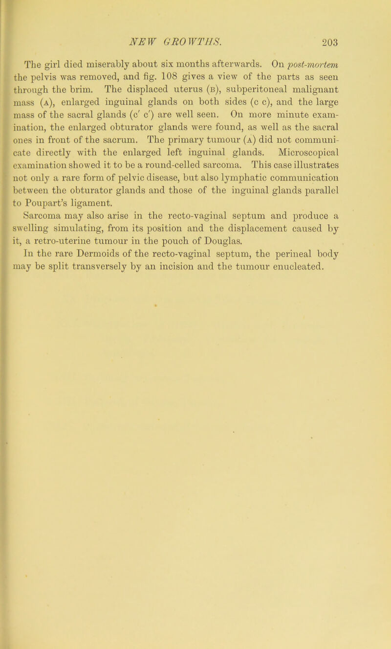 The girl died miserably about six months afterwards. On post-mortem the pelvis was removed, and fig. 108 gives a view of the parts as seen through the brim. The displaced uterus (b), subperitoneal malignant mass (a), enlarged inguinal glands on both sides (c c), and the large mass of the saci’al glands (c' c') are well seen. On more minute exam- ination, the enlarged obturator glands were found, as well as the sacral ones in front of the sacrum. The primary tumour (a) did not communi- cate directly with the enlarged left inguinal glands. Microscopical examination showed it to be a round-celled sarcoma. This case illustrates not only a rare form of pelvic disease, but also lymphatic communication between the obturator glands and those of the inguinal glands parallel to Poupart’s ligament. Sarcoma may also arise in the recto-vaginal septum and produce a swelling simulating, from its position and the displacement caused b)'^ it, a retro-uterine tumour in the pouch of Douglas. In the rare Dermoids of the recto-vaginal septum, the perineal body may be split transversely by an incision and the tumour enucleated.