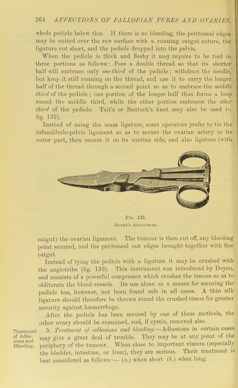 whole pedicle below this. If there is no bleeding, the peritoneal edges may be united over the raw surface with a running catgut suture, the ligature cut short, and the pedicle dropped into the pelvis. When the pedicle is thick and fleshy it may require to be tied in three portions as follows : Pass a double thread so that its shorter half will embrace only one-third of the pedicle; withdraw the needle, but keep it still running on the thi’ead, and use it to carry the longer half of the thread through a second point so as to embrace the middle third of the pedicle; one portion of the longer half thus forms a loop round the middle third, while the other portion embraces the other third of the pedicle. Tait’s or Bantock’s knot may also be used (v. %.132). Instead of using the mass ligature, some operators prefer to tie the infundibulo-pelvic ligament so as to secure the ovarian artery in its outer ]>art, then secure it on its uterine side, and also ligature (with Fio. 133. UoVEN'a ANaiorniiiE. catgut) the ovarian ligament. The tumour is then cut off, any bleeding l>oint secured, and the peritoneal cut edges brought together with fine catgut. Instead of tying the pedicle with a ligature it may be crushed with the angiotribe (fig. 133). This instrument was introduced by Doyen, and consists of a powerful compressor which crushes the tissues so as to obliterate the blood-vessels. Its use alone as a means for securing the pedicle has, however, not been found safe in all cases. A thin silk ligature should therefore be thrown round the crushed tissue for greater security against hmmorrhage. After the pedicle has been secured by one of these methods, the other ovary should be examined, and, if cystic, removed also. Treatment 5. Treatment of adhesions and bleeding.—Adhesions in certain cases of Adhe- inav give a great deal of trouble. They may be at any point of the Bleeding. ]jeriphery of the tumour. When close to important viscera (especiallj’ the bladder, intestine, or liver), they are serious. Their treatment is best considered as follows;— (a.) when shoi't (b.) when long.