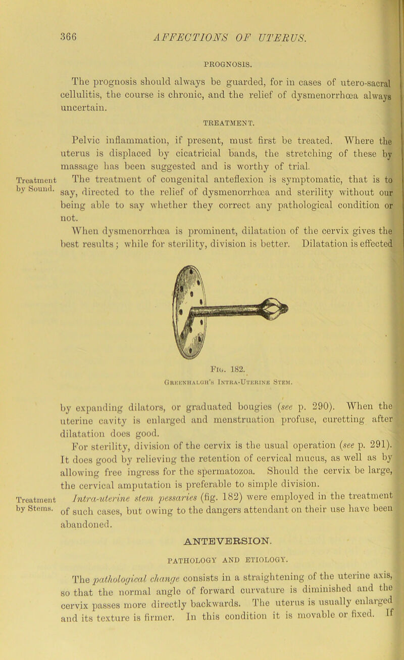 Treatment l)y Sound. Treatment by Stems. PROGNOSIS. The prognosis should always be guarded, for iu cases of utero-sacral cellulitis, the course is chronic, and the relief of dysmenorrhoea always uncertain. TREATMENT. Pelvic inflammation, if present, must first be treated. Where the uterus is displaced by cicatricial bands, the stretching of these by massage lias been suggested and is worthy of trial. The treatment of congenital anteflexion is symptomatic, that is to say, directed to tlie relief of dysmenorrhoea and sterility without our being able to say whether they correct any pathological condition or not. When dysmenorrha'a is prominent, dilatation of the cervix gives the best results ; while for sterility, division is better. Dilatation is effected- GiiKKNiiAt.aii’K Intka-Ut'krink Stem. by expanding dilators, or graduated bougies {see p. 290). When the uterine cavity is enlarged and menstruation profuse, curetting after dilatation does good. For sterility, division of the cervix is the usual operation (see p. 291). It does good by relieving the retention of cervical mucus, as well as by allowing free ingress for the spermatozoa. Should the cervix be large, the cervical amputation is preferable to simple division. Intra-uterine stem pessaries (fig. 182) were employed in the treatment of such cases, but owing to the dangers attendant on their use have been abandoned. ANTEVERSION. PATHOLOGY AND ETIOLOGY. The 2xitholoffical chanr/e consists in a straightening of the uterine axis, so that the normal angle of forward curvature is diminished and the cervix passes more directly backwards. The uterus is usually enlaiged and its texture is firmer. In this condition it is movable or fixed. If