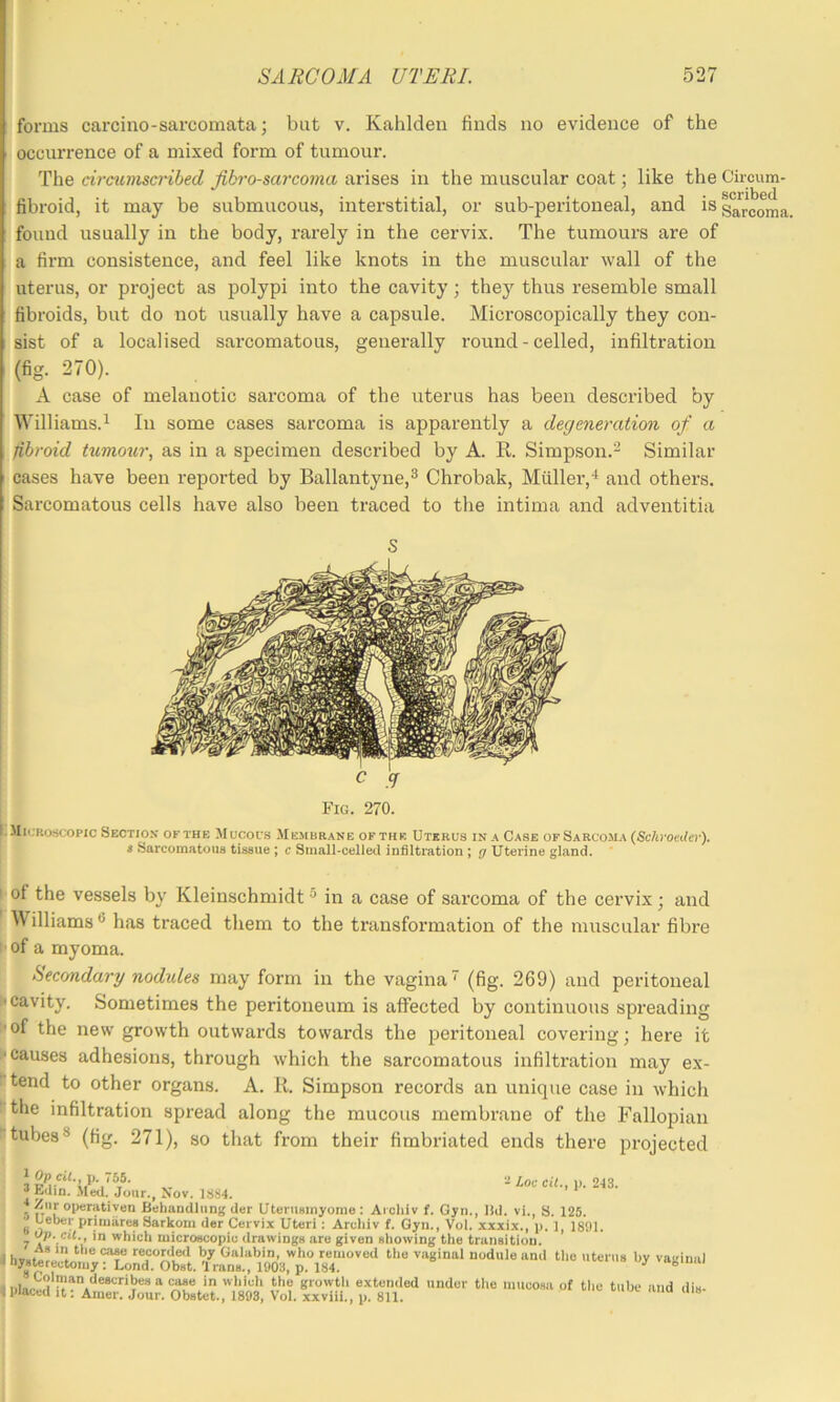 forms carcino - sarcomata; but v. Kahldeii finds no evidence of the occurrence of a mixed form of tumour. The circumscribed fibrosarcoma arises in the muscular coat; like the Circum- fibroid, it may be submucous, interstitial, or sub-peritoneal, and is sarcoma, found usually in the body, rarely in the cervix. The tumours are of a firm consistence, and feel like knots in the muscular wall of the uterus, or project as polypi into the cavity; they thus resemble small fibroids, but do not usually have a capsule. Microscopically they con- sist of a localised sarcomatous, generally round - celled, infiltration (fig. 270). A case of melanotic sarcoma of the uterus has been described by Williams.^ In some cases sarcoma is apparently a degeneration of a fibroid tumour, as in a specimen described by A. R. Simpson.'.^ Similar cases have been reported by Ballantyne,^ Chrobak, MiLller,* and others. Sarcomatous cells have also been traced to tlie intima and adventitia Fig. 270. ^Microscopic Section of the Mucous Membrane of the Uterus in a Case of Sarcoma (Schroaler). 8 Sarcomatous tissue ; c Small-celled infiltration ; g Uterine gland. I'of the vessels by Kleinschmidt ® in a case of sarcoma of the cervix; and [ AVilliams ® has traced them to the transformation of the muscular fibre ^of a myoma. Secondary nodules may form in the vagina (fig. 269) and peritoneal ^cavity. Sometimes the peritoneum is affected by continuous spreading jof the new growth outwards towards the peritoneal covering; here it I causes adhesions, through which the sarcomatous infiltration may ex- Itend to other organs. A. R. Simpson records an unique case in which I the infiltration spread along the mucous membrane of the Fallopian I tubes® (tig. 271), so that from their fimbriated ends there projected - Loe cit., i>. 243. 1 Op cU., p. 765. 3E(lin. Med. Jour., Nov. Ziir oiwrativen BchaDdlung iler UteruBinyome : Aichiv f. Gyn., lid. vi. S. 125. Ueber priniiires Sarkom der Cervix Uteri: Arcliiv f. Gyn., Vol. xxxix., p. ], 18SM. Op. cit., in vrliicli microecopiu drawinge are given nhowing the transition. i hv.»»r ‘1 ^ •’y CialRbin, who removed the vaginal nodule and tlie uterus by vaginal ' 8 0 i1903, p. 184. ^ afeinai 1 Dlaced ext«<led under the mucosa of the tube and dis- I placed It: Amer. Jour. Obstet., 1898, Vol. xxviii., p. 811.