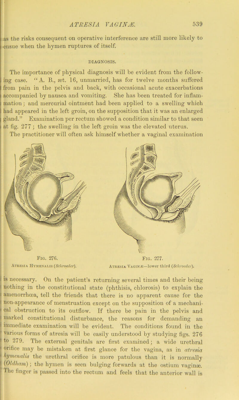 :as the risks consequent on operative interfei-ence are still more likely to .ensue when the hymen ruptures of itself. DIAGNOSIS. The importance of physical diagnosis will be evident from the follow- ing case. “A. B., set. 16, unmarried, has for twelve months suffered from pain in the pelvis and back, with occasional acute exacerbations accompanied by nausea and vomiting. She has been treated for inflam- mation ; and mercurial ointment had been applied to a swelling which had appeared in the left groin, on the supposition that it was an enlarged gland.” Examination per rectum showed a condition similar to that seen at fig. 277; the swelling in the left groin was the elevated uterus. The practitioner will often ask himself whether a vaginal examination Fig. 27G. ATREstA Hvmenalis (Schroeder). Fig. 277. Atresia Vaginae—lower third (Schroeder). is necessary. On the patient’s returning several times and their being nothing in the constitutional state (phthisis, chlorosis) to explain the ; amenorrhcea, tell the friends that there is no apparent cause for the non-appearance of menstruation except on the supposition of a mechani- cal obstruction to its outflow. If there be pain in the pelvis and marked constitutional disturbance, the reasons for demanding an immediate examination will be evident. The conditions found in the 'various forms of atresia will be easily understood by studying figs. 276 I to 279. The external genitals are first examined; a wide urethral ' orifice may be mistaken at first glance for the vagina, as in atresia ■ hymenalis the urethral orifice is more patulous than it is normally 'i {Oldham) ■, the hymen is seen bulging forwards at the ostium vaginas. The finger is passed into the rectum and feels that the anterior wall is I