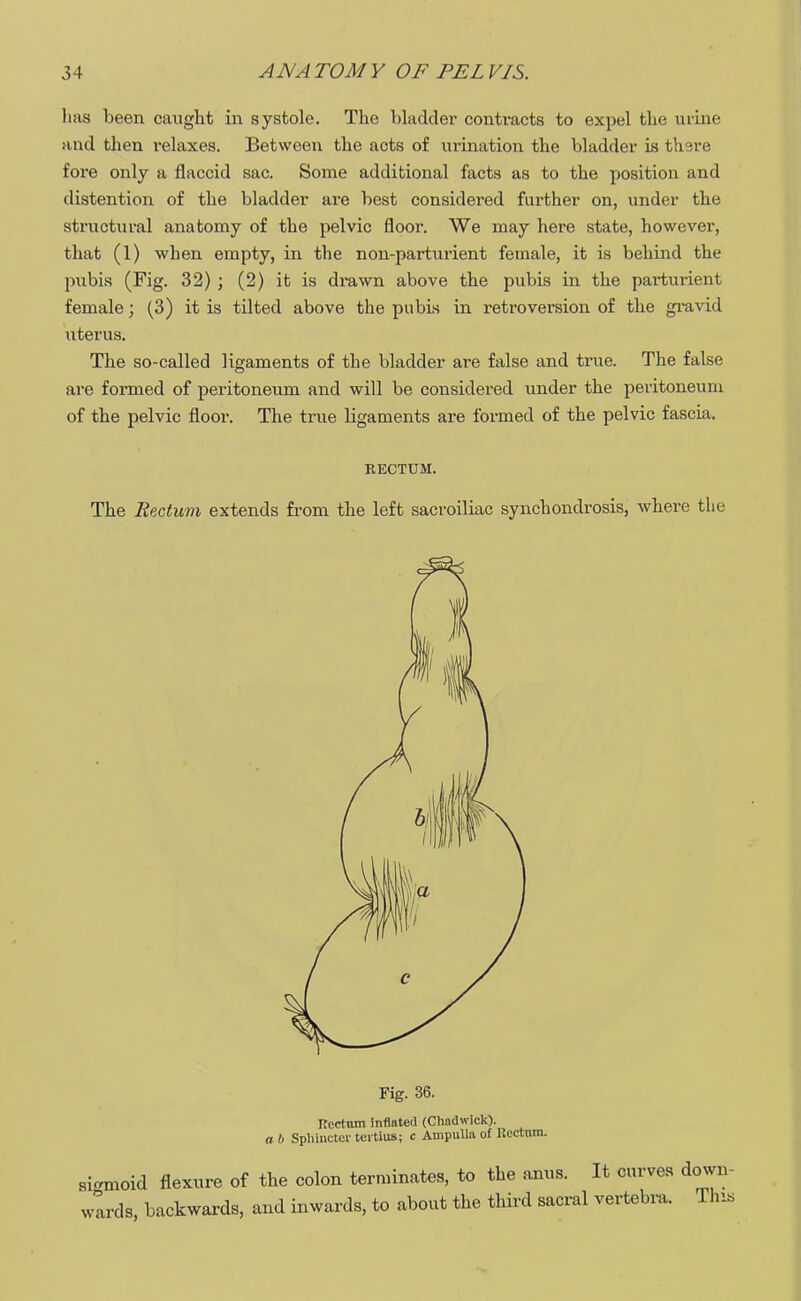 has been caught in systole. The bladder contracts to expel the mine and then relaxes. Between the acts of urination the bladder is there fore only a flaccid sac. Some additional facts as to the position and distention of the bladder are best considered further on, under the structural anatomy of the pelvic floor. We may here state, however, that (1) when empty, in the non-parturient female, it is behind the pubis (Fig. 32) ; (2) it is drawn above the pubis in the parturient female; (3) it is tilted above the pubis in retroversion of the gravid uterus. The so-called ligaments of the bladder are false and true. The false are formed of peritoneum and will be considered under the peritoneum of the pelvic floor. The true ligaments are formed of the pelvic fascia. RECTUM. The Rectum extends from the left sacroiliac synchondrosis, where the Fig. 36. Rectum Inflated (Chadwick). a b Sphincter teitius; c Ampulla of Rectum. sigmoid flexure of the colon terminates, to the anus. It curves down- wards, backwards, and inwards, to about the third sacral vertebra. This