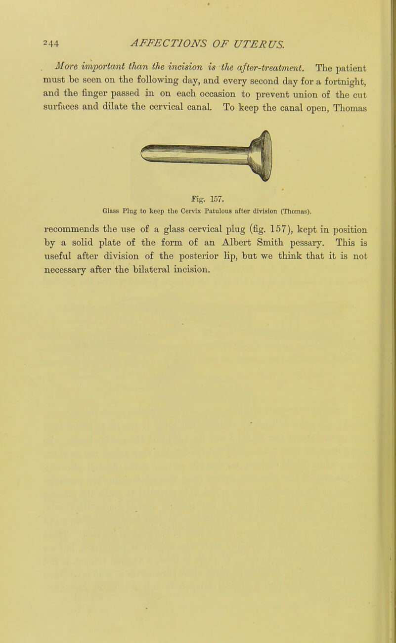 More important than the incision is the after-treatment. The patient must be seen on the following day, and every second day for a fortnight, and the finger passed in on each occasion to prevent union of the cut surfaces and dilate the cervical canal. To keep the canal open, Thomas Fig. 157. Glass Plug to keep the Cervix Patulous after division (Thomas). recommends the use of a glass cervical plug (fig. 157), kept in position by a solid plate of the form of an Albert Smith pessary. This is useful after division of the posterior lip, but we think that it is not necessary after the bilateral incision.