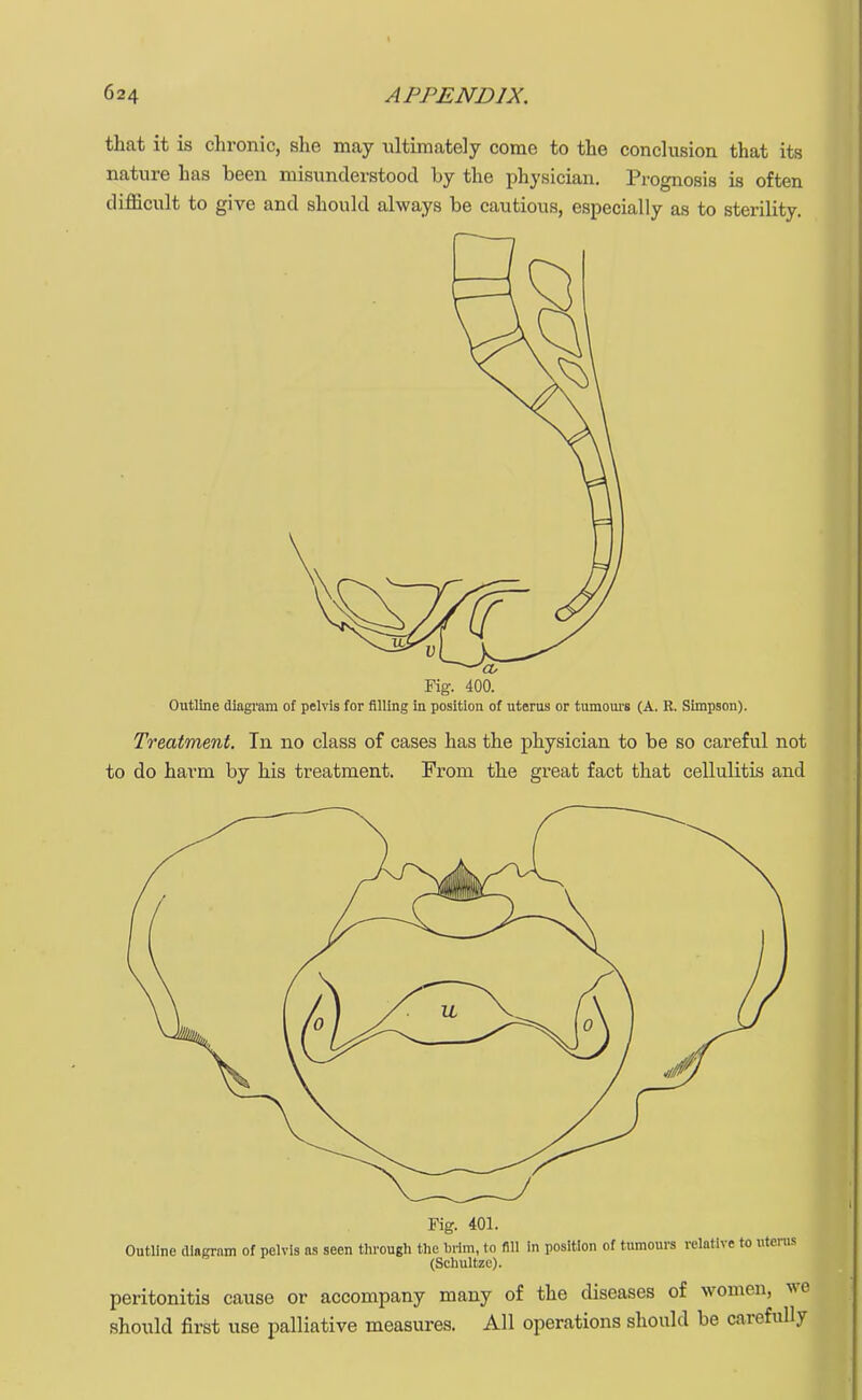 that it is chronic, she may ultimately come to the conclusion that its nature has been misunderstood by the physician. Prognosis is often difficult to give and should always be cautious, especially as to sterility. Fig. 400. Outline diagram of pelvis for filling in position of uterus or tumours (A. R. Simpson). Treatment. In no class of cases has the physician to be so careful not to do harm by his treatment. From the great fact that cellulitis and Fig. 401. Outline diagram of pelvis as seen through the brim, to fill in position of tumours relative to uterus (Schultze). peritonitis cause or accompany many of the diseases of women, we should first use palliative measures. All operations should be carefully