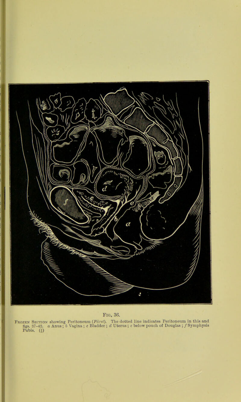 Frozen Section showing Peritoneum (FiirM). The dotted line indicates Peritoneum in this and figs. 37-42. a Anus ; 6 Vagina ; c Bladder ; d Uterus ; c below pouch of Douglas ; / Symphysis Pubis. (S)