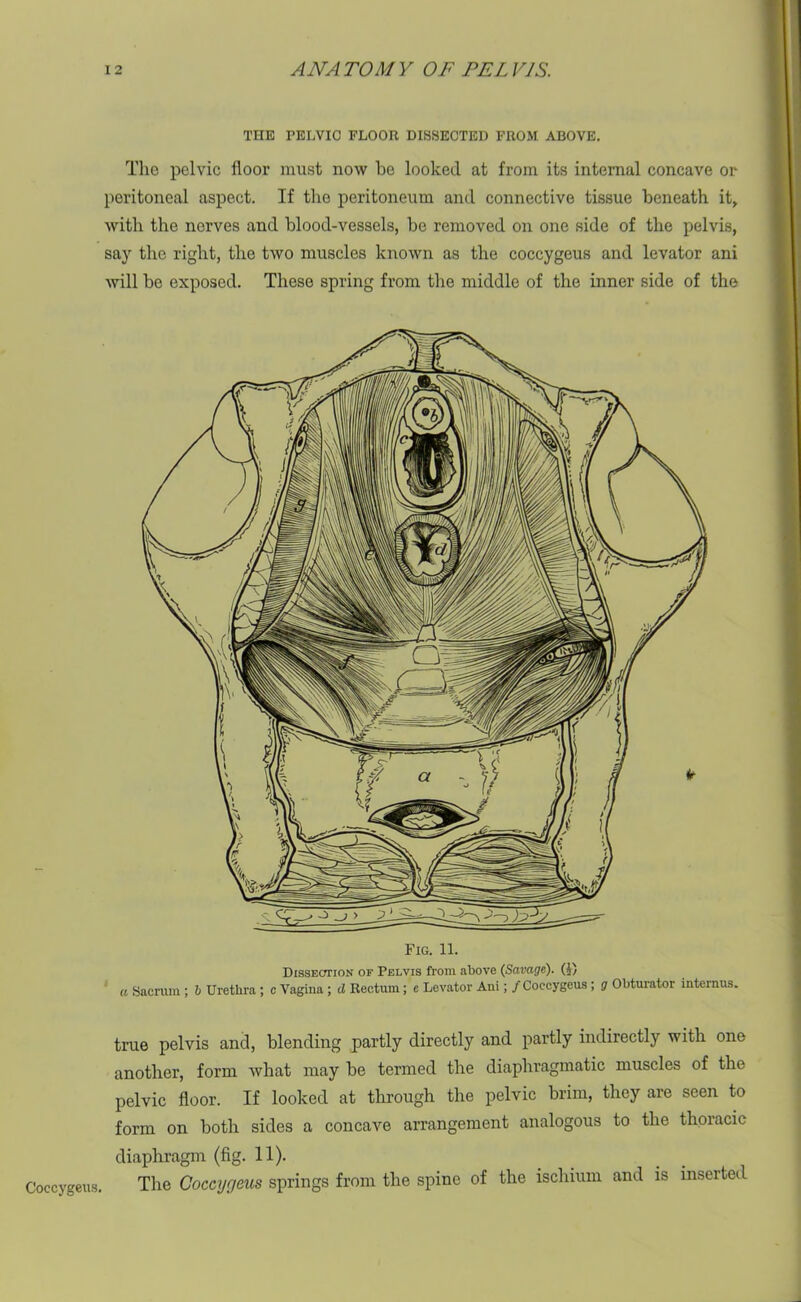 Coccygetis. THE PELVIC FLOOR DISSECTED FROM ABOVE. The pelvic floor must now he looked at from its internal concave or peritoneal aspect. If the peritoneum and connective tissue beneath it, with the nerves and blood-vessels, be removed on one side of the pelvis, say the right, the two muscles known as the coccygeus and levator ani will be exposed. These spring from the middle of the inner side of the Fig. 11. Dissection of Pelvis from above (Savage). (A) a Sacrum ; b Urethra ; c Vagina ; cl Rectum ; e Levator Ani; / Coccygeus ; g Obturator internus. true pelvis and, blending partly directly and partly indirectly with one another, form what may be termed the diaphragmatic muscles of the pelvic floor. If looked at through the pelvic brim, they are seen to form on both sides a concave arrangement analogous to the thoracic diaphragm (fig. 11). The Coccygeus springs from the spine of the ischium and is inserted