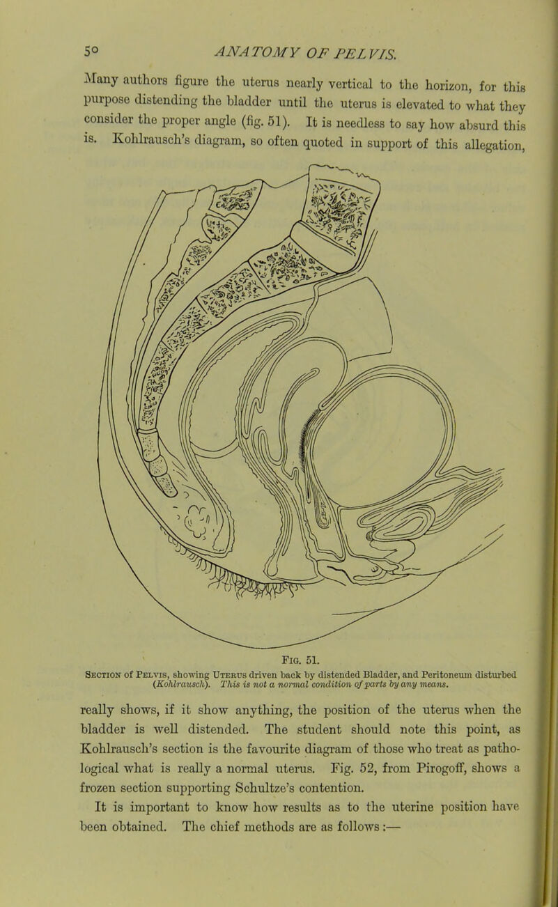 Many authors figure the uterus nearly vertical to the horizon, for this purpose distending the bladder until the uterus is elevated to what they consider the proper angle (fig. 51). It is needless to say how absurd this is. Kohlrausch’s diagram, so often quoted in support of this allegation, Fig. 51. Section of Pelvis, showing Uterus driven back by distended Bladder, and Peritoneum disturbed (Kohlrauscli). This is not a normal condition of parts by any means. really shows, if it show anything, the position of the uterus when the bladder is wrell distended. The student should note this point, as Kohlrausch’s section is the favourite diagram of those who treat as patho- logical what is really a normal uterus. Fig. 52, from Pirogoff, shows a frozen section supporting Schultze’s contention. It is important to know how results as to the uterine position have been obtained. The chief methods are as follows:—