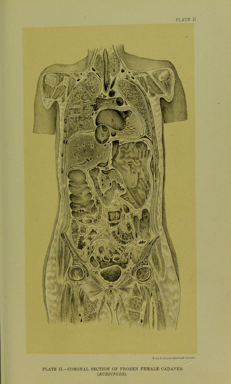 W A London PLATE II.—CORONAL SECTION OE FROZEN FEMALE CADAVER (RUEDI NO Eli).