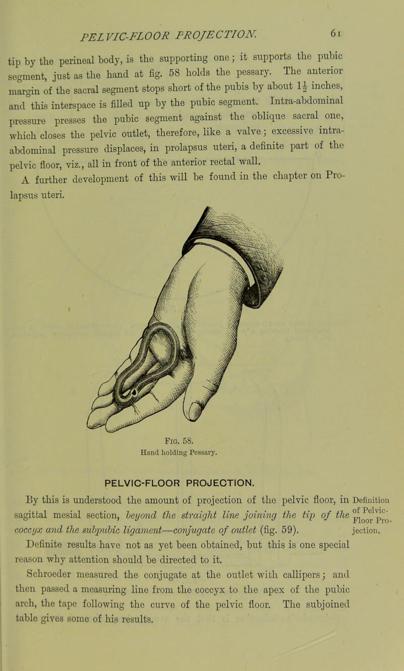 tip by the perineal body, is the supporting one; it supports the pubic segment, just as the hand at fig. 58 holds the pessary. The anterior margin of the sacral segment stops short of the pubis by about H inches, and°this interspace is filled up by the pubic segment. Intra-abdominal pressure presses the pubic segment against the oblique sacral one, which closes the pelvic outlet, therefore, like a valve; excessive mtra- abdominal pressure displaces, in prolapsus uteri, a definite part of the pelvic floor, viz., all in front of the anterior rectal wall. A further development of this will be found in the chapter on Pro- lapsus uteri. Fig. 58. Hand holding Pessary. PELVIC-FLOOR PROJECTION. By this is understood the amount of projection of the pelvic floor, in Definition •sagittal mesial section, beyond the straight line joining the tip of the i^Pro coccyx and the subpubic ligament—conjugate of outlet (fig. 59). jection. Definite results have not as yet been obtained, but this is one special reason why attention should be directed to it. Schroeder measured the conjugate at the outlet with callipers; and then passed a measuring line from the coccyx to the apex of the pubic arch, the tape following the curve of the pelvic floor. The subjoined table gives some of his results.