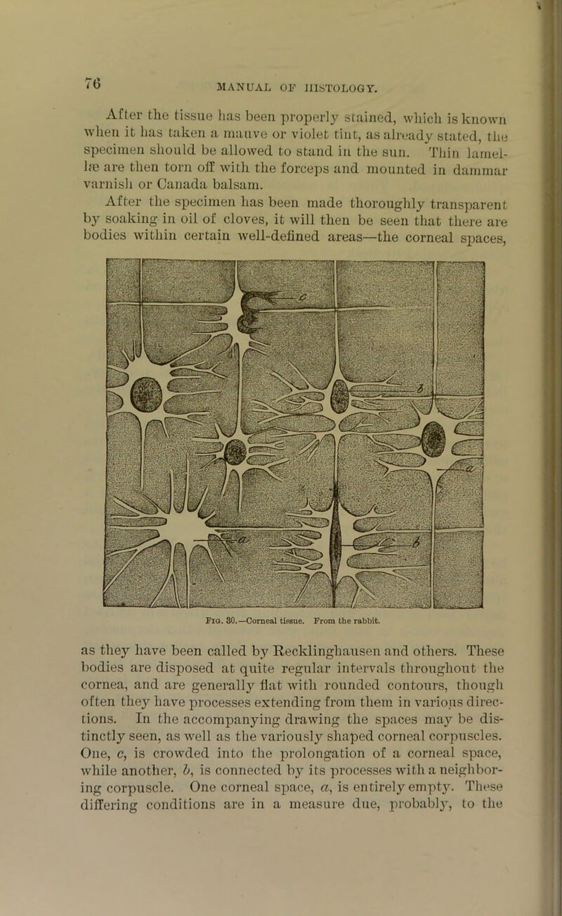 After tlie tissue has been properly stained, which is known when it has taken a mauve or violet tint, as already stated, the specimen should be allowed to stand in the sun. Thin larnel- he are then torn off with the forceps and mounted in dammar varnish or Canada balsam. After the specimen has been made thoroughly transparent by soaking in oil of cloves, it will then be seen that there are bodies within certain well-defined areas—the corneal spaces, Fig. 30.—Corneal tissue. From the rabbit. as they have been called by Recklinghausen and others. These bodies are disposed at quite regular intervals throughout the cornea, and are generally flat with rounded contours, though often they have processes extending from them in various direc- tions. In the accompanying drawing the spaces may be dis- tinctly seen, as well as the variously shaped corneal corpuscles. One, c, is crowded into the prolongation of a corneal space, while another, b, is connected by its processes with a neighbor- ing corpuscle. One corneal space, a, is entirely empty. These differing conditions are in a measure due, probably, to the