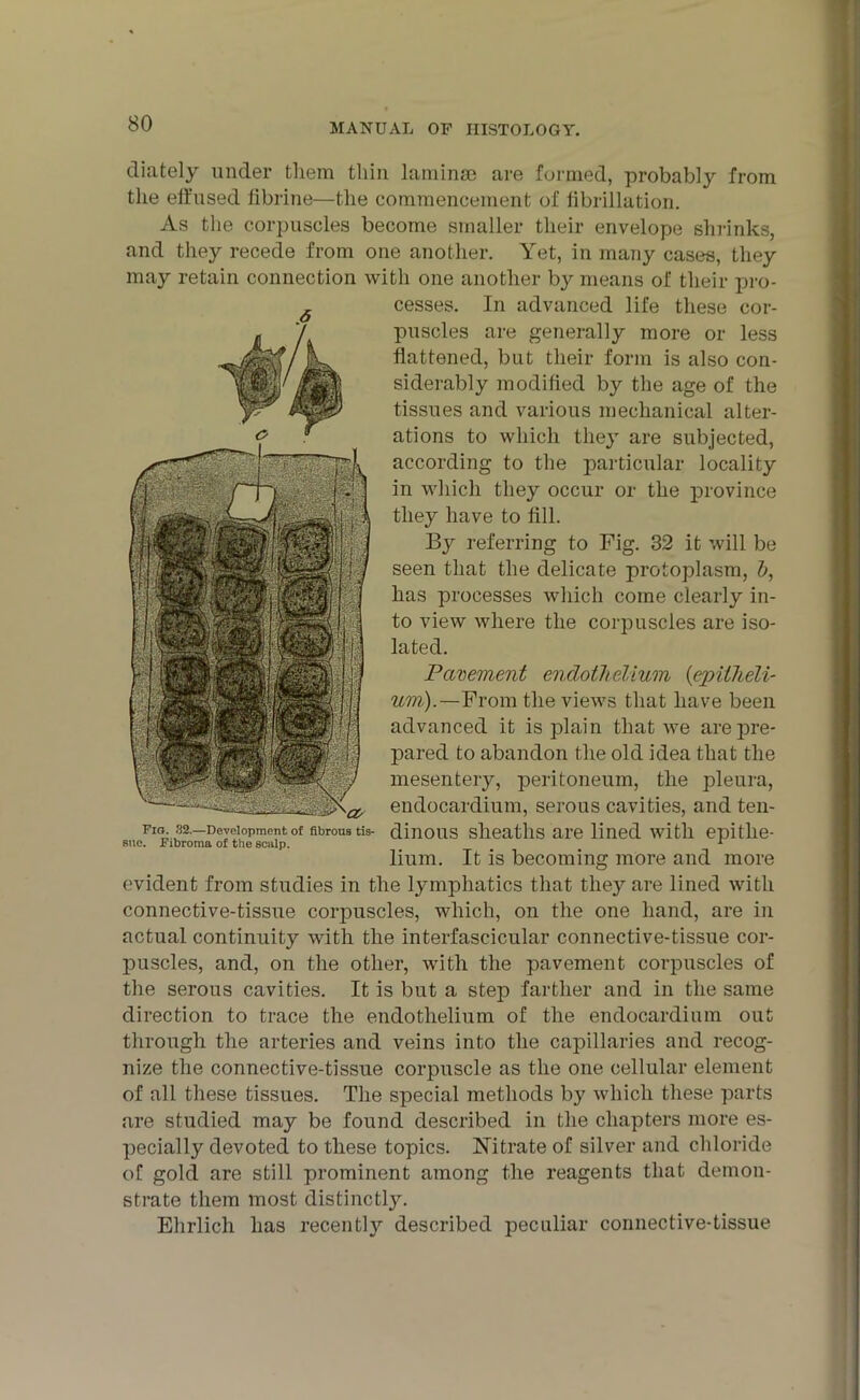 diately under them thin laminae are formed, probably from the effused fibrine—the commencement of fibrillation. As the corpuscles become smaller their envelope shrinks, and they recede from one another. Yet, in many cases, they may retain connection with one another by means of their pro- cesses. In advanced life these cor- puscles are generally more or less flattened, but their form is also con- siderably modified by the age of the tissues and various mechanical alter- ations to which they are subjected, according to the particular locality in which they occur or the province they have to fill. By referring to Fig. 32 it will be seen that the delicate protoplasm, b, has processes which come clearly in- to view where the corpuscles are iso- lated. Pavement endothelium (epitheli- um).—From the views that have been advanced it is plain that we arepre- rlOKMirimilinfflr•: pared to abandon the old idea that the \v J mesentery, peritoneum, the pleura, .. :.pjS\a endocardium, serous cavities, and ten- Fl<b.'S2—Der’opment of fibrous ns- dinous sheaths are lined with epithe- sue. Fibroma of the scalp. < 1 lium. It is becoming more and more evident from studies in the lymphatics that the}’- are lined with connective-tissue corpuscles, which, on the one hand, are in actual continuity with the interfascicular connective-tissue cor- puscles, and, on the other, with the pavement corpuscles of the serous cavities. It is but a step farther and in the same direction to trace the endothelium of the endocardium out through the arteries and veins into the capillaries and recog- nize the connective-tissue corpuscle as the one cellular element of all these tissues. The special methods by which these parts are studied may be found described in the chapters more es- pecially devoted to these topics. Nitrate of silver and chloride of gold are still prominent among the reagents that demon- strate them most distinctly. Ehrlich has recently described peculiar connective-tissue