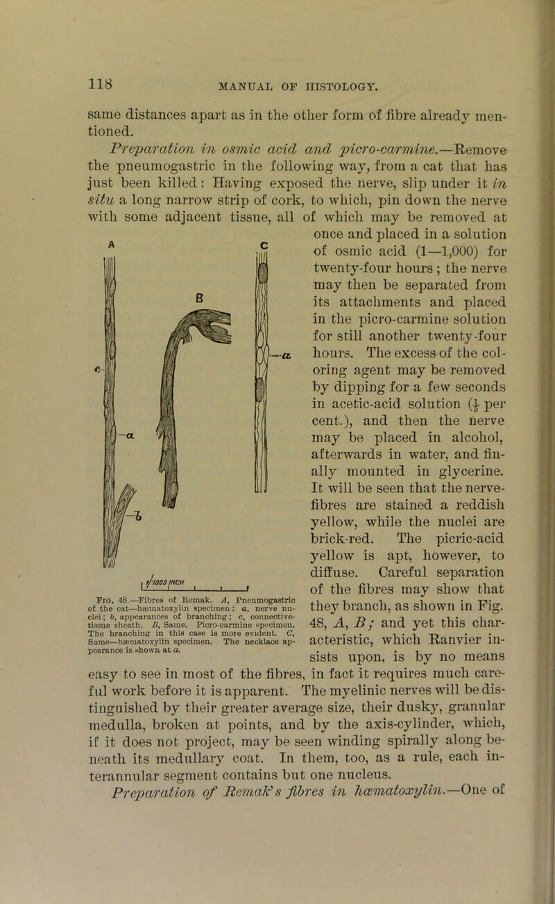 ■CL same distances apart as in the other form of fibre already men- tioned. Preparation in osmic acid and picro-carmine.—Remove the pneumogastric in the following way, from a cat that has just been killed: Having exposed the nerve, slip under it in situ a long narrow strip of cork, to which, pin down the nerve with some adjacent tissue, all of which may be removed at once and placed in a solution of osmic acid (1—1,000) for twenty-four hours ; the nerve may then be separated from its attachments and placed in the picro-carmine solution for still another twenty-four hours. The excess of the col- oring agent may be removed by dipping for a few seconds in acetic-acid solution Q- per cent.), and then the nerve may be placed in alcohol, afterwards in water, and fin- ally mounted in glycerine. It will be seen that the nerve- fibres are stained a reddish yellow, while the nuclei are brick-red. The picric-acid yellow is apt, however, to diffuse. Careful separation of the fibres may show that they branch, as shown in Fig. 48, A, B; and yet this char- acteristic, which Ranvier in- sists upon, is by no means easy to see in most of the fibres, in fact it requires much care- ful work before it is apparent. The myelinic nerves will be dis- tinguished by their greater average size, their dusky, granular medulla, broken at points, and by the axis-cylinder, which, if it does not project, may be seen winding spirally along be- neath its medullary coat. In them, too, as a rule, each in- terannular segment contains but one nucleus. Preparation of Romaic's fibres in hcematoxylin.—One of • i/iaoo inch J Fio. 48.—Fibres of Uemak. A, Pneumogastric of the cat—hsematoxylin specimen : a, nerve nu- clei; b, appearances of branching; c, connective- tissue Bheath. B, Same. Picro-carmine specimen. The branching in this case is more evident. C, Same—hoematoxylin specimen. The necklace ap- pearance is shown at a.