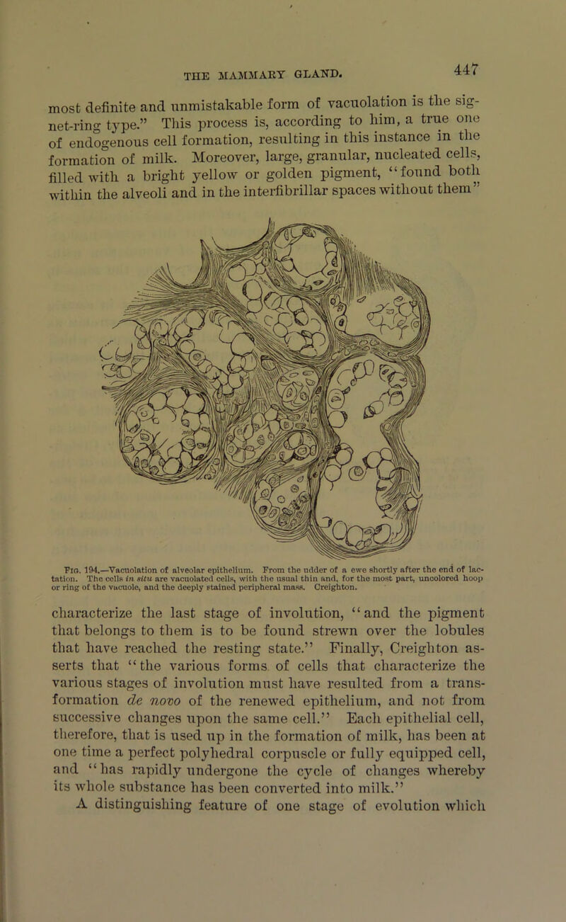 most definite and unmistakable form of vacuolation is tlie sig- net-ring type.” This process is, according to him, a true one of endogenous cell formation, resulting in this instance in the formation of milk. Moreover, large, granular, nucleated cells, filled with a bright yellow or golden pigment, “ found both within the alveoli and in the interfibrillar spaces without them” Fig. 104.—Vacuolation of alveolar epithelium. From the udder of a ewe shortly after the end of lac- tation. The cells in situ are vacuolated cells, with the usual thin and, for the most part, uncolored hoop or ring of the vacuole, and the deeply stained peripheral mass. Creighton. characterize the last stage of involution, “and the pigment that belongs to them is to be found strewn over the lobules that have reached the resting state.” Finally, Creighton as- serts that “the various forms of cells that characterize the various stages of involution must have resulted from a trans- formation cle novo of the renewed epithelium, and not from successive changes upon the same cell.” Each epithelial cell, therefore, that is used up in the formation of milk, has been at one time a perfect polyhedral corpuscle or fully equipped cell, and “has rapidly undergone the cycle of changes whereby its whole substance has been converted into milk.” A distinguishing feature of one stage of evolution which