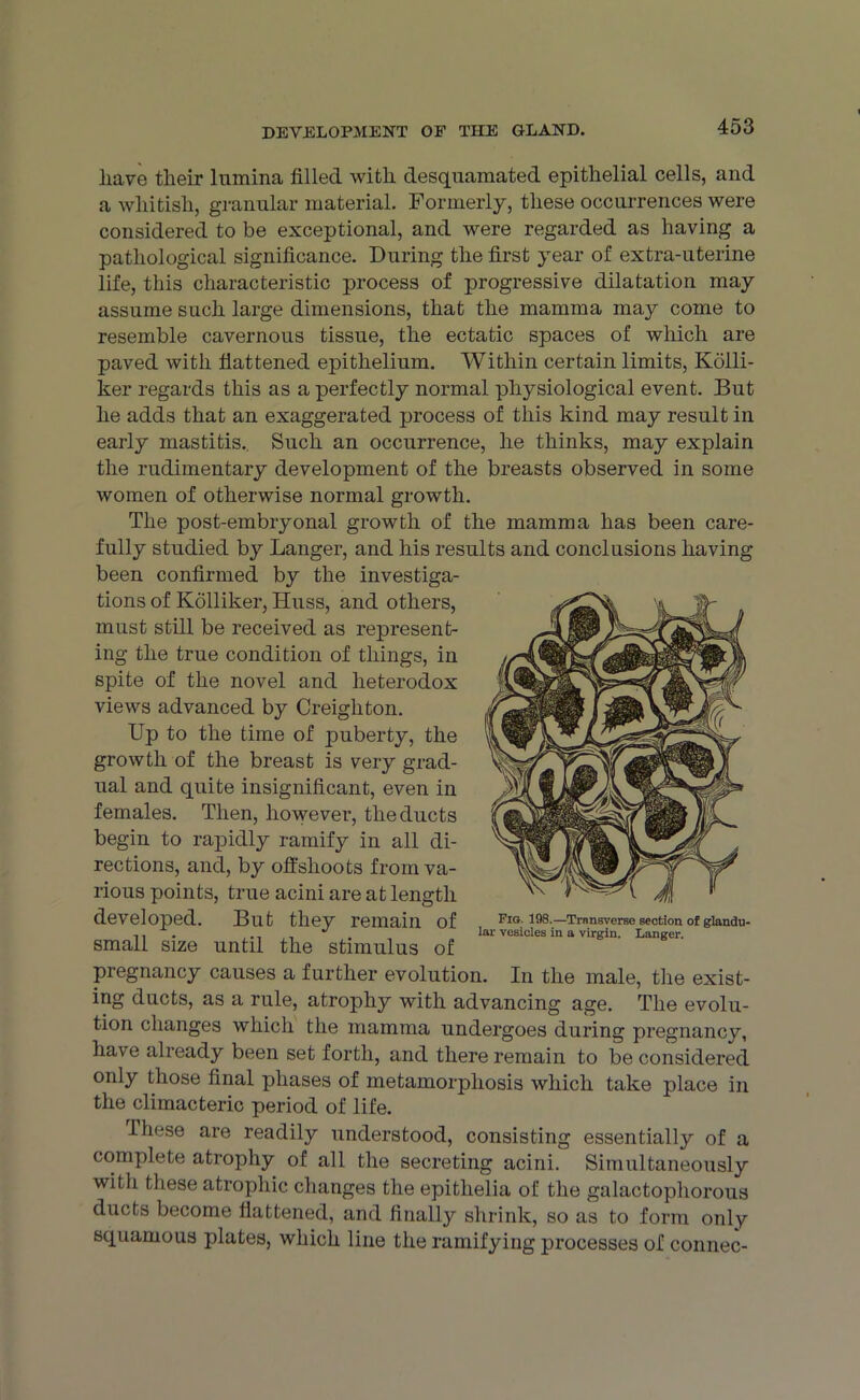 have their lumina tilled with desquamated epithelial cells, and a whitish, granular material. Formerly, these occurrences were considered to be exceptional, and were regarded as having a pathological significance. During the first year of extra-uterine life, this characteristic process of progressive dilatation may assume such large dimensions, that the mamma may come to resemble cavernous tissue, the ectatic spaces of which are paved with flattened epithelium. Within certain limits, Kolli- ker regards this as a perfectly normal physiological event. But he adds that an exaggerated process of this kind may result in early mastitis.. Such an occurrence, he thinks, may explain the rudimentary development of the breasts observed in some women of otherwise normal growth. The post-embryonal growth of the mamma has been care- fully studied by Langer, and his results and conclusions having been confirmed by the investiga- tions of Kolliker, Huss, and others, must still be received as represent- ing the true condition of things, in spite of the novel and heterodox views advanced by Creighton. Up to the time of puberty, the growth of the breast is very grad- ual and quite insignificant, even in females. Then, however, the ducts begin to rapidly ramify in all di- rections, and, by offshoots from va- rious points, true acini are at length developed. But they remain of small size until the stimulus of pregnancy causes a further evolution. In the male, the exist- ing ducts, as a rule, atrophy with advancing age. The evolu- tion changes which the mamma undergoes during pregnancy, have already been set forth, and there remain to be considered only those final phases of metamorphosis which take place in the climacteric period of life. these are readily understood, consisting essentially of a complete atrophy of all the secreting acini. Simultaneously with these atrophic changes the epithelia of the galactophorous ducts become flattened, and finally shrink, so as to form only squamous plates, which line the ramifying processes of connec- Fig. 198.—Transverse section of glandu- lar vesicles in a virgin. Langer.