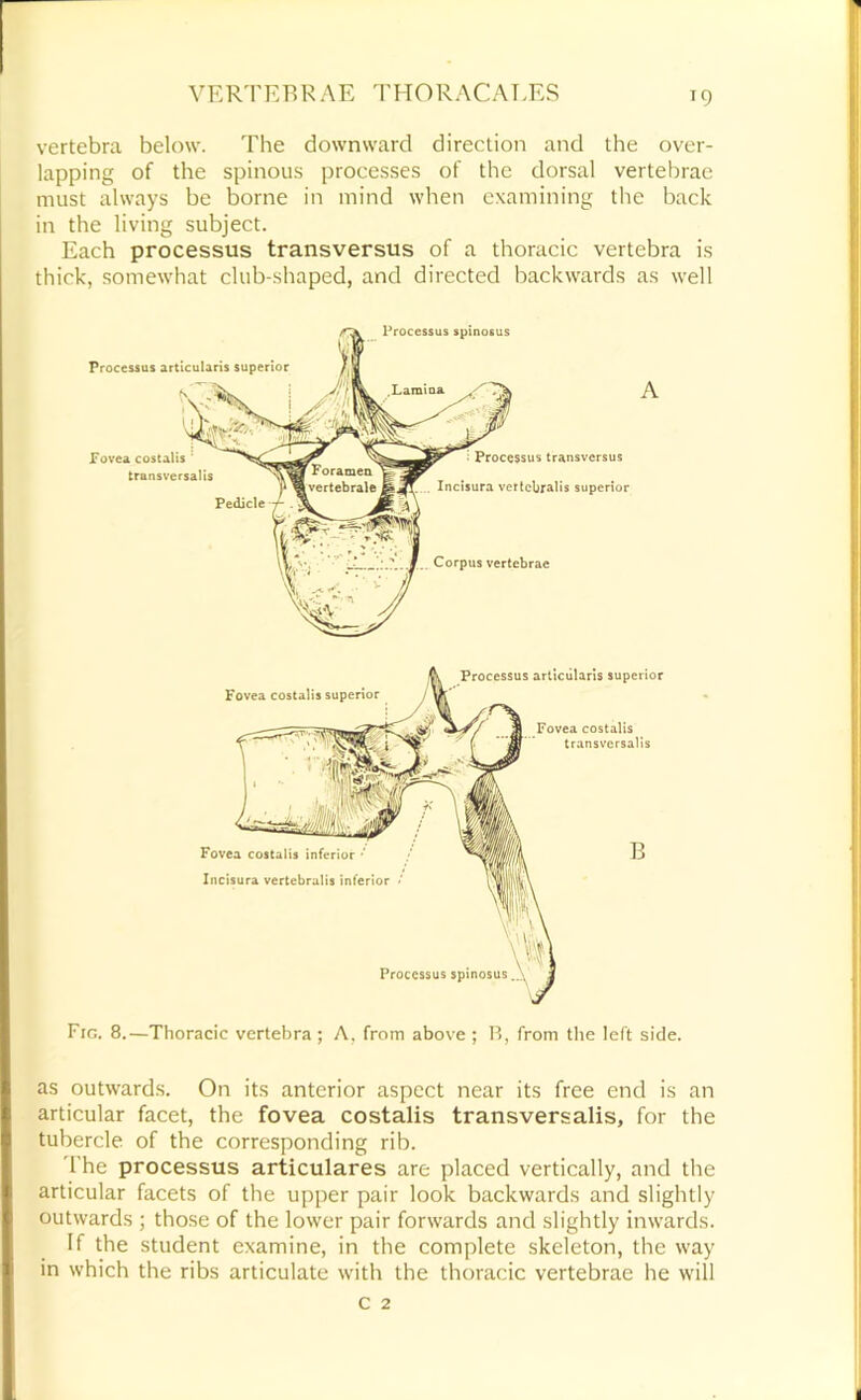 •9 vertebra below. The downward direction and the over- lapping of the spinous processes of the dorsal vertebrae must always be borne in mind when examining the back in the living subject. Each processus transversus of a thoracic vertebra is thick, somewhat club-shaped, and directed backwards as well Fovea costalis transversalis Pedicle Processus transversus Incisura vertcbralis superior Corpus vertebrae Processus artlcularis superior Processus spinosus A Fig. 8.—Thoracic vertebra ; A, from above ; from the left side. Fovea costalis superior Fovea costalis inferior • Incisura vertebralis inferior ‘ cessus artlcularis superior Fovea costalis transversalis Processus spinosus as outwards. On its anterior aspect near its free end is an articular facet, the fovea costalis transversalis, for the tubercle of the corresponding rib. 'I'he processus articulares are placed vertically, and the articular facets of the upper pair look backwards and slightly outwards ; those of the lower pair forwards and slightly inwards. If the student examine, in the complete skeleton, the way in which the ribs articulate with the thoracic vertebrae he will