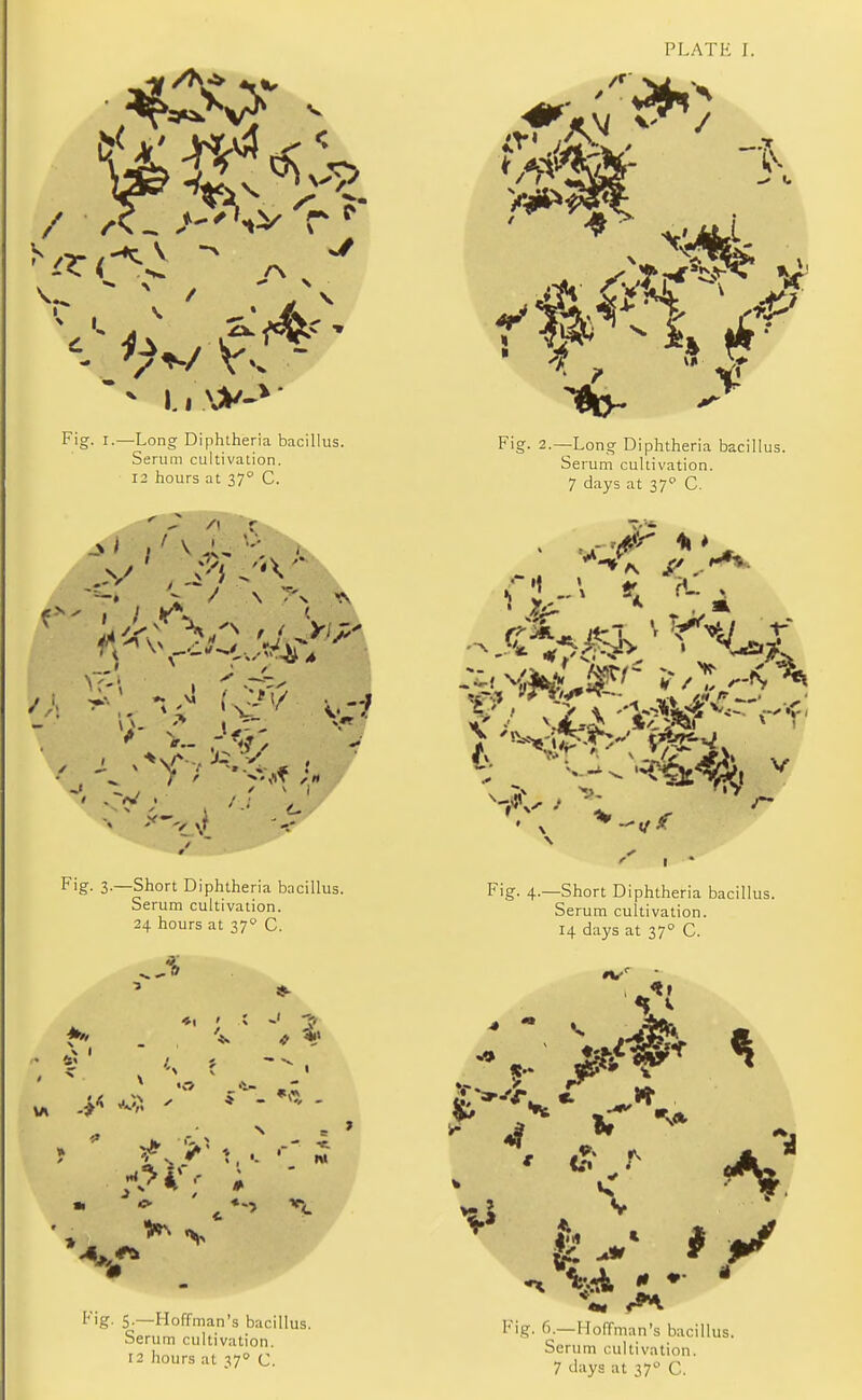 PLATE I.  A ^ ^ / % J \ K <* A ^ S!<X&' > < v. - I.!*-1' Fig. r.—Long Diphtheria bacillus. Serum cultivation. 12 hours at 37° C. ' - A r .v' , ^ - Fig- 2.—Long Diphtheria bacillus. Serum cultivation. 7 days at 37° C. Fig. 3.—Short Diphtheria bacillus. Serum cultivation. 24 hours at 370 C. .3 \ 1 Fig. 4.—Short Diphtheria bacillus. Serum cultivation. 14 days at 370 C. Fig. 5.—Hoffman's bacillus. Serum cultivation. 12 hours at 370 C. Fig. 6.—1 toffman's bacillus. Serum cultivation. 7 days at 370 C.