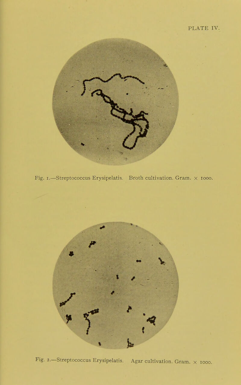 Fig. 2.—Streptococcus Erysipelatis. Agar cultivation. Gram, x iooo.