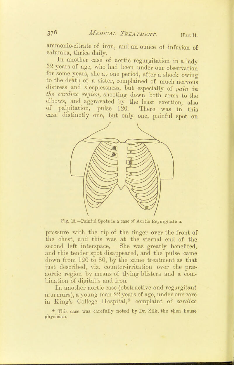 ammonio citrate of iron, and an ounce of infusion of caluniba, thrice daily. In another case of aortic regurgitation in a lady 32 years of age, who had been under our observation for some years, she at oue period, after a shock owiiifr to the death of a sister, complained of much nervous distress and sleeplessness, but especially of fain in the cardiac region, shooting down both arms to the elbows, and aggravated by the least exertion, also of palpitation, pulse 120. There was in this case distinctly one, but only one, painful spot on Fig. 13.—Painful Spots iu a case of Aortic Re^jurgitation. pressure with the tip of the finger over the front of the chest, and this was at the sternal end of the second left interspace, She was greatly benefited, and this tender spot disappeared, and the pulse came down from 120 to 80, by the same treatment as that ju.st described, viz. counter-irritation over the prae- aortic region by means of flying blisters and a com- bination of disiitalis and iron. In another aortic case (obstructive and regurgitant murmurs), a young man 22 years of age, under our care in King's College Hospital,* complaint of cardiac * This case was carefully noted by Dr. Silk, the then house physician.