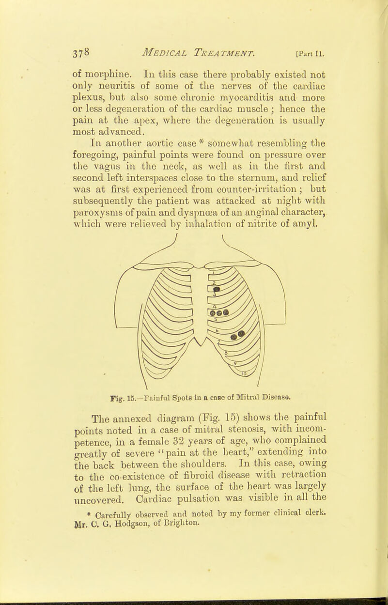 of morphine. In this case there probably existed not only neuritis of some of the nerves of the cardiac plexus, but also some cln*onic myocarditis and more or less degeneration of the cardiac muscle ; hence the pain at the apex, where the degeneration is usually most advanced. In another aortic case * somewhat resemblins: the foregoing, painful points were found on pressure over the vagus in the neck, as well as in the first and second left interspaces close to the sternum, and relief was at first experienced from counter-irritation ; but subsequently the patient was attacked at night with paroxysms of pain and dyspnoea of an anginal character, which were relieved by inhalation of nitrite of amyl. Fig. 15.—rniuful Spots in a cneo of Mitral Discaso. The annexed diagram (Fig. 15) shows the painful points noted in a case of mitral steno.sis, with incom- petence, in a female 32 years of age, who complained greatly of severe pain at the heart, extending into the back between the shoulders. In this case, owing to the co-existence of fibroid disease with retraction of the left lung, the surface of the heart was largely uncovered. Cardiac pulsation was visible in all the * Carefully observed and noted by my former clinical clerk. Mr. 0. G. Hodgson, of Brighton.