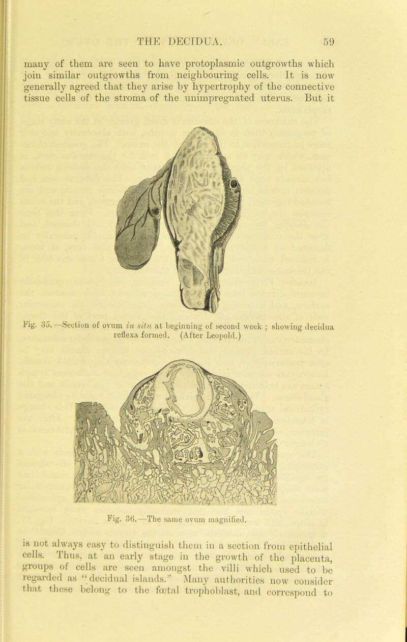 many of them are seen to have protoplasmic outgrowths which join similar outgrowths from neighbouring cells. It is now generally agreed that they arise by hypertrophy of the connective tissue cells of the stroma of the uuimpregnated uterus. But it tig. S5.—.Section of ovum in situ at beginning of second week ; showing decidua reflexa formed. (After Leopold.) Fig. 30.—The same ovum magnilied. is not always esisy to distinguisli them in a section from epithelial celhs. Thus, at an early stage in the growth of the placenta, groups of cells are seen amongst the villi which used to l)c legal (led as decidual islands. Many authorities now consider that these belong to the foetal trophoblast, and corresixmd to