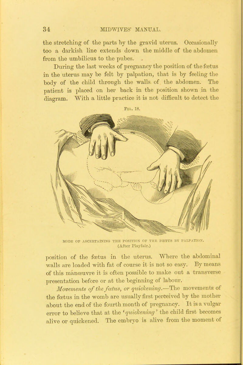 the stretching of the parts hy the gravid uterus. Occasionally too a darkish line extends down the middle of the abdomen from the umbilicus to the pubes. During the last weeks of pregnancy the position of the foetus in the uterus may be felt by palpation, that is by feeling the body of the child through the walls of the abdomen. The patient is placed on her back in the position shown in the diagram. With a little practice it is not difficult to detect the Fid. 18. MODE OP ASCERTAINING THE POSITION OF THE FCETUS BY PALPATION. (After Playfair.) position of the foetus in the uterus. Where the abdominal walls are loaded with fat of course it is not so easy. By means of this manoeuvre it is often possible to make out a transverse presentation before or at the beginning of labour. Movements of the foetus, or quickening.—The movements of the foetus in the womb are usually first perceived by the mother about the end of the fourth month of pregnancy. It is a vulgar error to believe that at the ‘quickening ’ the child first becomes alive or quickened. The embryo is alive from the moment of