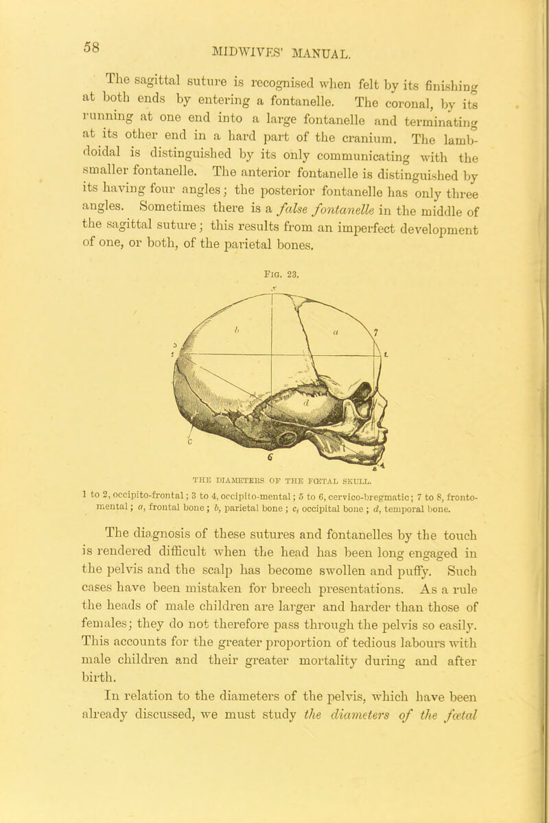 The sagittal suture is recognised when felt by its finishing at both ends by entering a fontanelle. The coronal, by its running at one end into a large fontanelle and terminating at its other end in a hard part of the cranium. The laml> iloidal is distinguished by its only communicating with the smaller fontanelle. The anterior fontanelle is distinguished by its having four angles; the posterior fontanelle has only three angles. Sometimes there is a false fontanelle in the middle of the sagittal suture; this results from an imperfect development of one, or both, of the parietal bones. THE DIAMETERS OF THE FCETAL SKULL. 1 to 2, occipito-frontal; 3 to 4, occipito-mental; <5 to 6, cervico-bregmatic; 7 to 8, fronto- mental; a, frontal bone ; b, parietal bone ; c, occipital bone ; d, temporal bone. The diagnosis of these sutures and fontanelles by the touch is rendered difficult when the head has been long engaged in the pelvis and the scalp has become swollen and puffy. Such cases have been mistaken for breech presentations. As a rule the heads of male children are larger and harder than those of females; they do not therefore pass through the pelvis so easily. This accounts for the greater proportion of tedious labours with male children and their greater mortality during and after birth. In relation to the diameters of the pelvis, which have been already discussed, we must study the diameters of the foetal Fig. 23. a