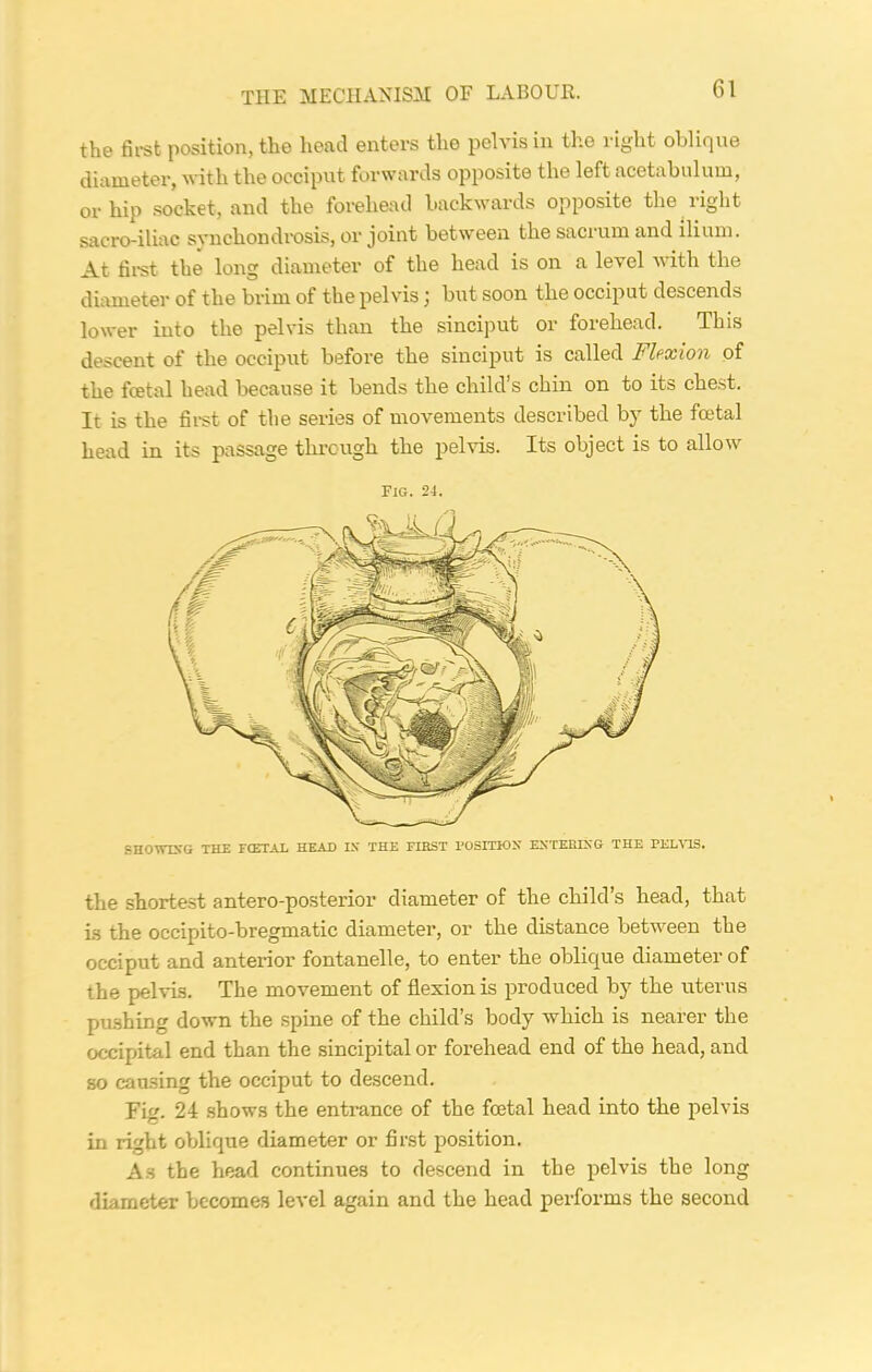 THE MECHANISM OF LABOUR. the first position, the head enters the pelvis in the right oblique diameter, with the occiput forwards opposite the left acetabulum, or hip socket, and the forehead backwards opposite the right sacro-iliac svnchondrosis, or joint between the sacium and ilium. At first the long diameter of the head is on a level with the diameter of the brim of the pelvis; but soon the occiput descends lower into the pelvis than the sinciput or forehead. This descent of the occiput before the sinciput is called Flexion of the foetal head because it bends the child’s chin on to its chest. It is the first of the series of movements described by the foetal head in its passage through the pelvis. Its object is to allow fig. 24. SHOWING THE FCETAL HEAD IS THE FIRST POSITION ENTERING THE PELVIS. the shortest antero-posterior diameter of the child’s head, that is the occipito-bregmatic diameter, or the distance between the occiput and anterior fontanelle, to enter the oblique diameter of the pelvis. The movement of flexion is produced by the uterus pushing down the spine of the child’s body which is nearer the occipital end than the sincipital or forehead end of the head, and so causing the occiput to descend. Fig. 24 shows the entrance of the foetal head into the pelvis in right oblique diameter or first position. As the head continues to descend in the pelvis the long diameter becomes level again and the head performs the second