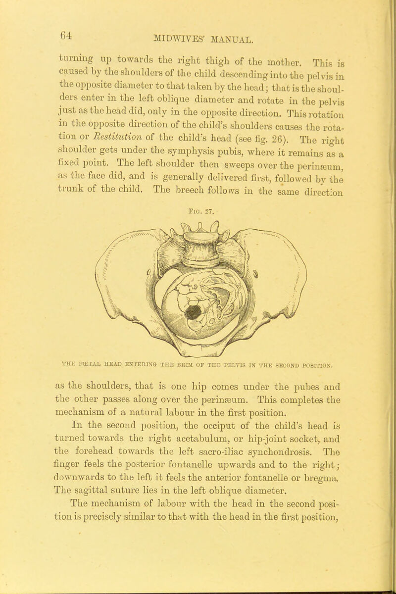 turning up towards the right thigh of the mother. This is caused b}’ the shoulders of the child descending into the pelvis in the opposite diameter to that taken by the head ; that is the shoul- ders enter in the left oblique diameter and rotate in the pelvis just as the head did, only in the opposite direction. This rotation in the opposite direction of the child’s shoulders causes the rota- tion or Restitution of the child’s head (see fig. 26). The right shoulder gets under the symphysis pubis, where it remains as a fixed point. The left shoulder then sweeps over the perimeum, as the face did, and is generally delivered first, followed by the trunk of the child. The breech follows in the same direction Pig. 27. THE FOETAL HEAD ENTERING THE BRIM OF THE PELVIS IN THE SECOND POSITION. as the shoulders, that is one hip comes under the pubes and the other passes along over the perinseum. This completes the mechanism of a natural labour in the first position. In the second position, the occiput of the child’s head is turned towards the right acetabulum, or hip-joint socket, and the forehead towards the left sacro-iliac synchondrosis. The finger feels the posterior fontanelle upwards and to the right; downwards to the left it feels the anterior fontanelle or bregma. The sagittal suture lies in the left oblique diameter. The mechanism of labour with the head in the second posi- tion is precisely similar to that with the head in the first position,