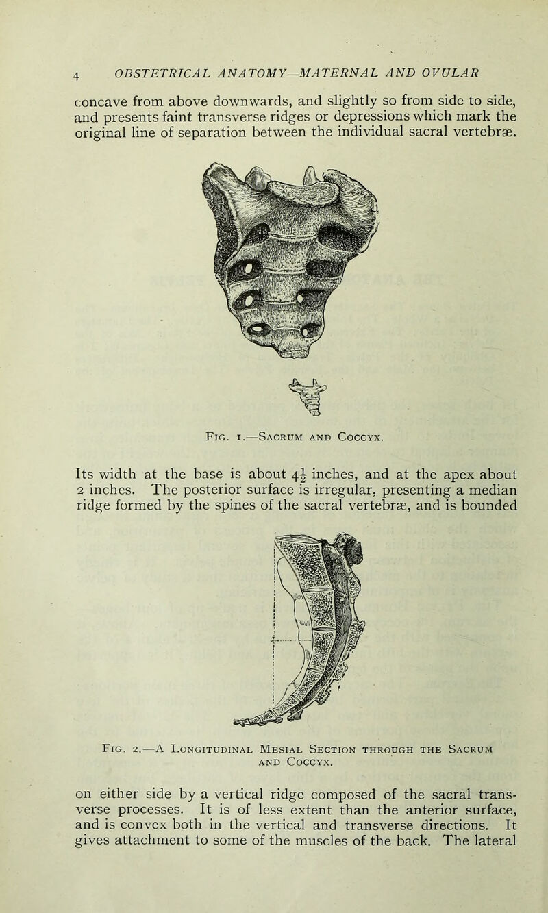 concave from above downwards, and slightly so from side to side, and presents faint transverse ridges or depressions which mark the original line of separation between the individual sacral vertebrae. Fig. i.—Sacrum and Coccyx. Its width at the base is about 4J inches, and at the apex about 2 inches. The posterior surface is irregular, presenting a median ridge formed by the spines of the sacral vertebrae, and is bounded Fig. 2.—A Longitudinal Mesial Section through the Sacrum and Coccyx. on either side by a vertical ridge composed of the sacral trans- verse processes. It is of less extent than the anterior surface, and is convex both in the vertical and transverse directions. It gives attachment to some of the muscles of the back. The lateral