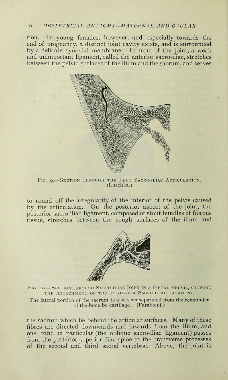 tion. In young females, however, and especially towards the end of pregnancy, a distinct joint cavity exists, and is surrounded by a delicate synovial membrane. In front of the joint, a weak and unimportant ligament, called the anterior sacro-iliac, stretches between the pelvic surfaces of the ilium and the sacrum, and serves Fig. g.—Section through the Left Sacro-iliac Articulation. (Luschka.) to round off the irregularity of the interior of the pelvis caused by the articulation. On the posterior aspect of the joint, the posterior sacro-iliac ligament, composed of stout bundles of fibrous tissue, stretches between the rough surfaces of the ilium and Fig. io.—Section through Sacro-iliac Joint in a Fcetal Pelvis, showing the Attachment of the Posterior Sacro-iliac Ligament. The lateral portion of the sacrum is also seen separated from the remainder of the bone by cartilage. (Farabceuf.) the sacrum which lie behind the articular surfaces. Many of these fibres are directed downwards and inwards from the ilium, and one band in particular (the oblique sacro-iliac ligament) passes from the posterior superior iliac spine to the transverse processes of the second and third sacral vertebrae. Above, the joint is