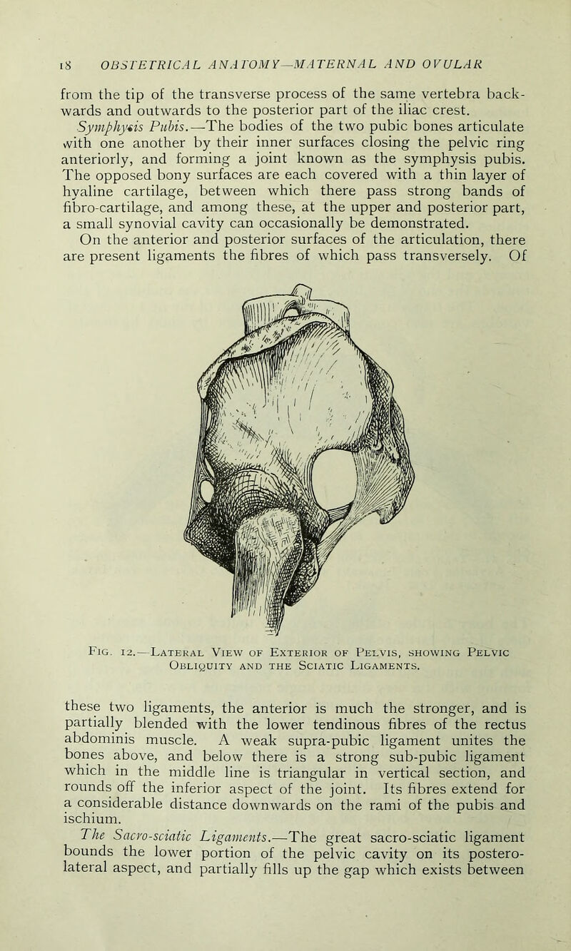 from the tip of the transverse process of the same vertebra back- wards and outwards to the posterior part of the iliac crest. Symphysis Pubis.— The bodies of the two pubic bones articulate with one another by their inner surfaces closing the pelvic ring anteriorly, and forming a joint known as the symphysis pubis. The opposed bony surfaces are each covered with a thin layer of hyaline cartilage, between which there pass strong bands of fibro-cartilage, and among these, at the upper and posterior part, a small synovial cavity can occasionally be demonstrated. On the anterior and posterior surfaces of the articulation, there are present ligaments the fibres of which pass transversely. Of Fig. i2.—Lateral View of Exterior of Pelvis, showing Pelvic Obliquity and the Sciatic Ligaments. these two ligaments, the anterior is much the stronger, and is partially blended with the lower tendinous fibres of the rectus abdominis muscle. A weak supra-pubic ligament unites the bones above, and below there is a strong sub-pubic ligament which in the middle line is triangular in vertical section, and rounds off the inferior aspect of the joint. Its fibres extend for a considerable distance downwards on the rami of the pubis and ischium. The Sacro-sciatic Ligaments.—The great sacro-sciatic ligament bounds the lower portion of the pelvic cavity on its postero- lateral aspect, and partially fills up the gap which exists between