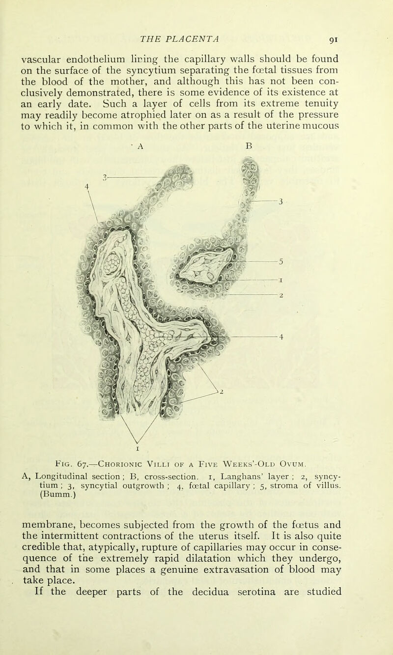 vascular endothelium lining the capillary walls should be found on the surface of the syncytium separating the foetal tissues from the blood of the mother, and although this has not been con- clusively demonstrated, there is some evidence of its existence at an early date. Such a layer of cells from its extreme tenuity may readily become atrophied later on as a result of the pressure to which it, in common with the other parts of the uterine mucous Fig. 67.—Chorionic Villi of a Five Weeks’-Old Ovum. A, Longitudinal section; B, cross-section, x, Langhans’ layer; 2, syncy- tium ; 3, syncytial outgrowth ; 4, foetal capillary ; 5, stroma of villus. (Bumm.) membrane, becomes subjected from the growth of the foetus and the intermittent contractions of the uterus itself. It is also quite credible that, atypically, rupture of capillaries may occur in conse- quence of the extremely rapid dilatation which they undergo, and that in some places a genuine extravasation of blood may take place. If the deeper parts of the decidua serotina are studied