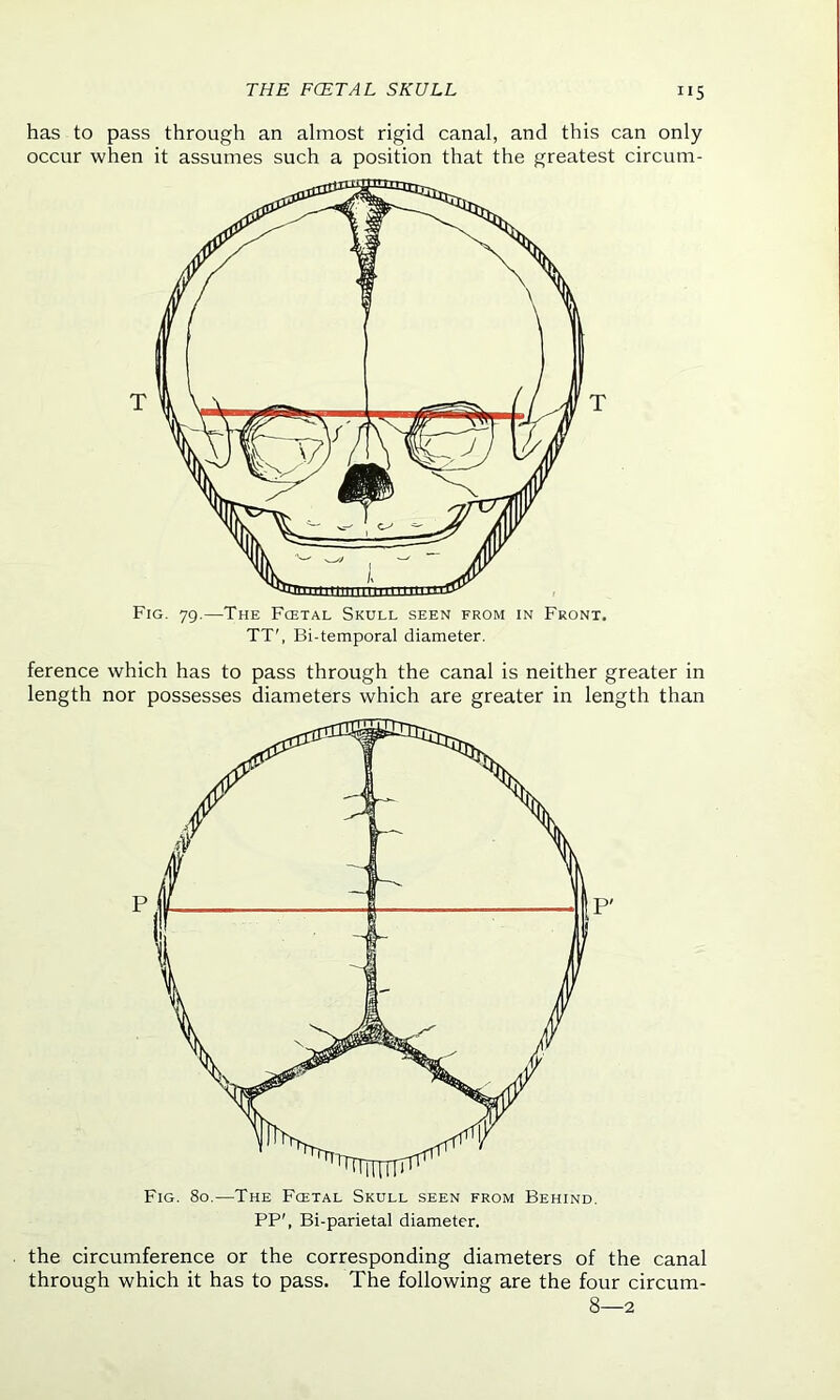 has to pass through an almost rigid canal, and this can only occur when it assumes such a position that the greatest circurn- Fig. 79.—The Fcetal Skull seen from in Front. TT', Bi-temporal diameter. ference which has to pass through the canal is neither greater in length nor possesses diameters which are greater in length than PP', Bi-parietal diameter. the circumference or the corresponding diameters of the canal through which it has to pass. The following are the four circum- 8—2