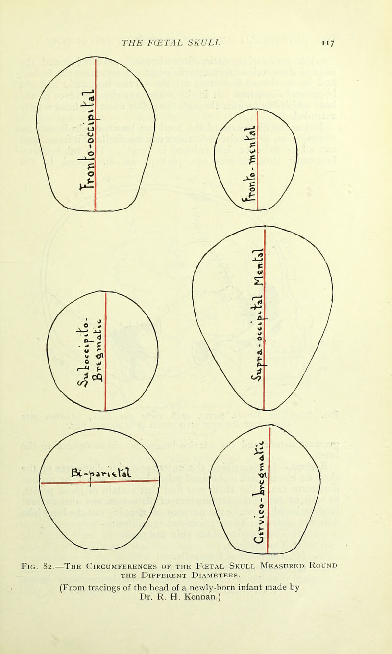 Fig. 82.—The Circumferences of the Fcetal Skull Measured Round the Different Diameters. (From tracings of the head of a newly-born infant made by Dr. R. H. Kennan.)