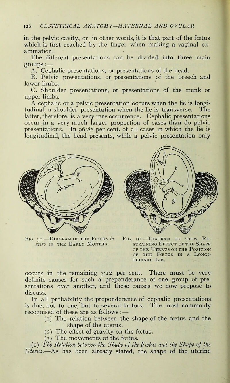 in the pelvic cavity, or, in other words, it is that part of the foetus which is first reached by the finger when making a vaginal ex- amination. The different presentations can be divided into three main groups:— A. Cephalic presentations, or presentations of the head. B. Pelvic presentations, or presentations of the breech and lower limbs. C. Shoulder presentations, or presentations of the trunk or upper limbs. A cephalic or a pelvic presentation occurs when the lie is longi- tudinal, a shoulder presentation when the lie is transverse. The latter, therefore, is a very rare occurrence. Cephalic presentations occur in a very much larger proportion of cases than do pelvic presentations. In g6'88 per cent, of all cases in which the lie is longitudinal, the head presents, while a pelvic presentation only Fig. go.—Diagram of the Fcetus in Fig. 91.—Diagram to show Re- occurs in the remaining 3-12 per cent. There must be very definite causes for such a preponderance of one group of pre- sentations over another, and these causes we now propose to discuss. In all probability the preponderance of cephalic presentations is due, not to one, but to several factors. The most commonly recognised of these are as follows :— (1) The relation between the shape of the foetus and the shape of the uterus. (2) The effect of gravity on the foetus. (3) The movements of the foetus. (1) The Relation between the Shape of the Foetus and the Shape of the Uterus.—As has been already stated, the shape of the uterine utero in the Early Months. straining Effect of the Shape of the Uterus on the Position of the Fcetus in a Longi- tudinal Lie,